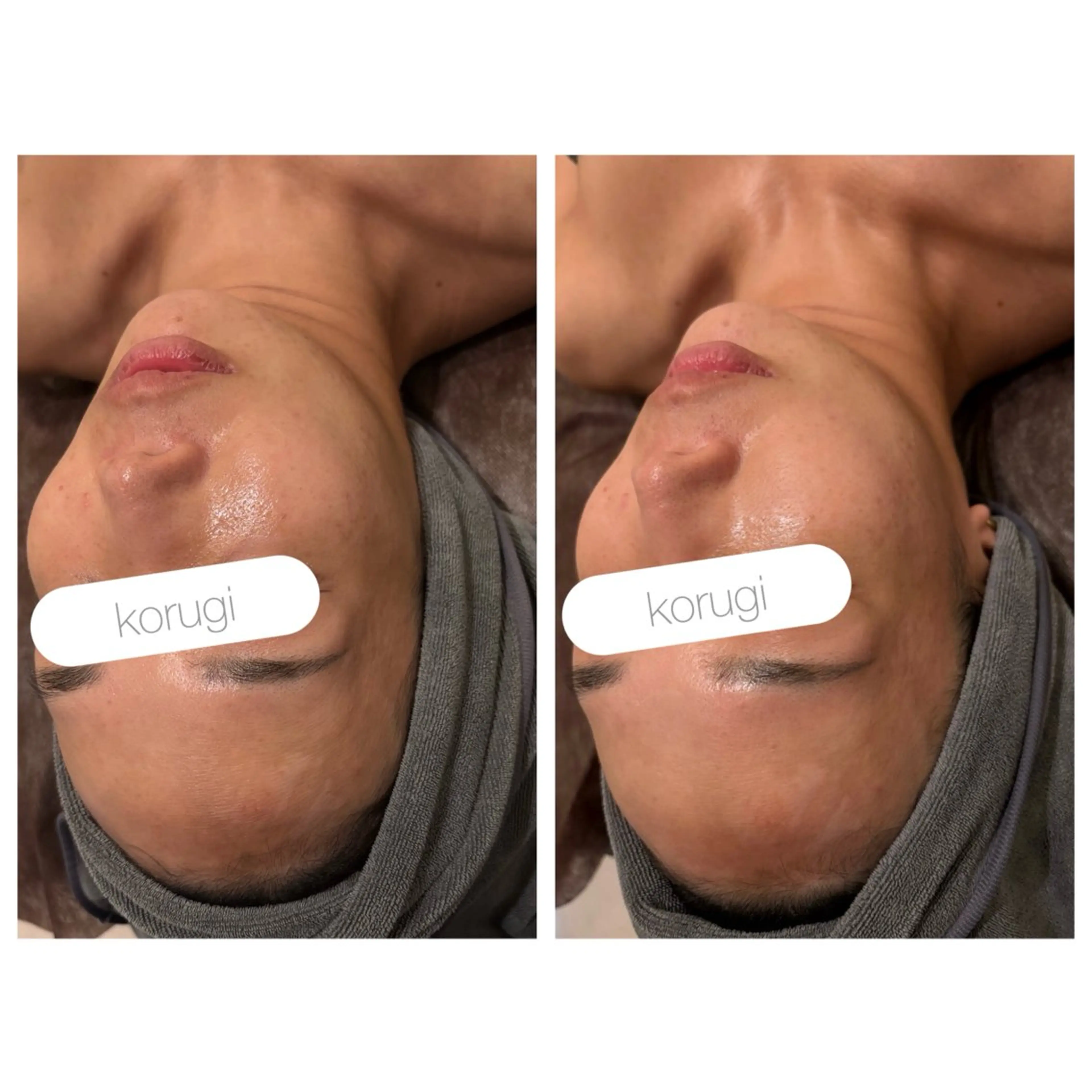 エステ 小顔コルギ ☆表参道/外苑前のエステ・リラクイメージ