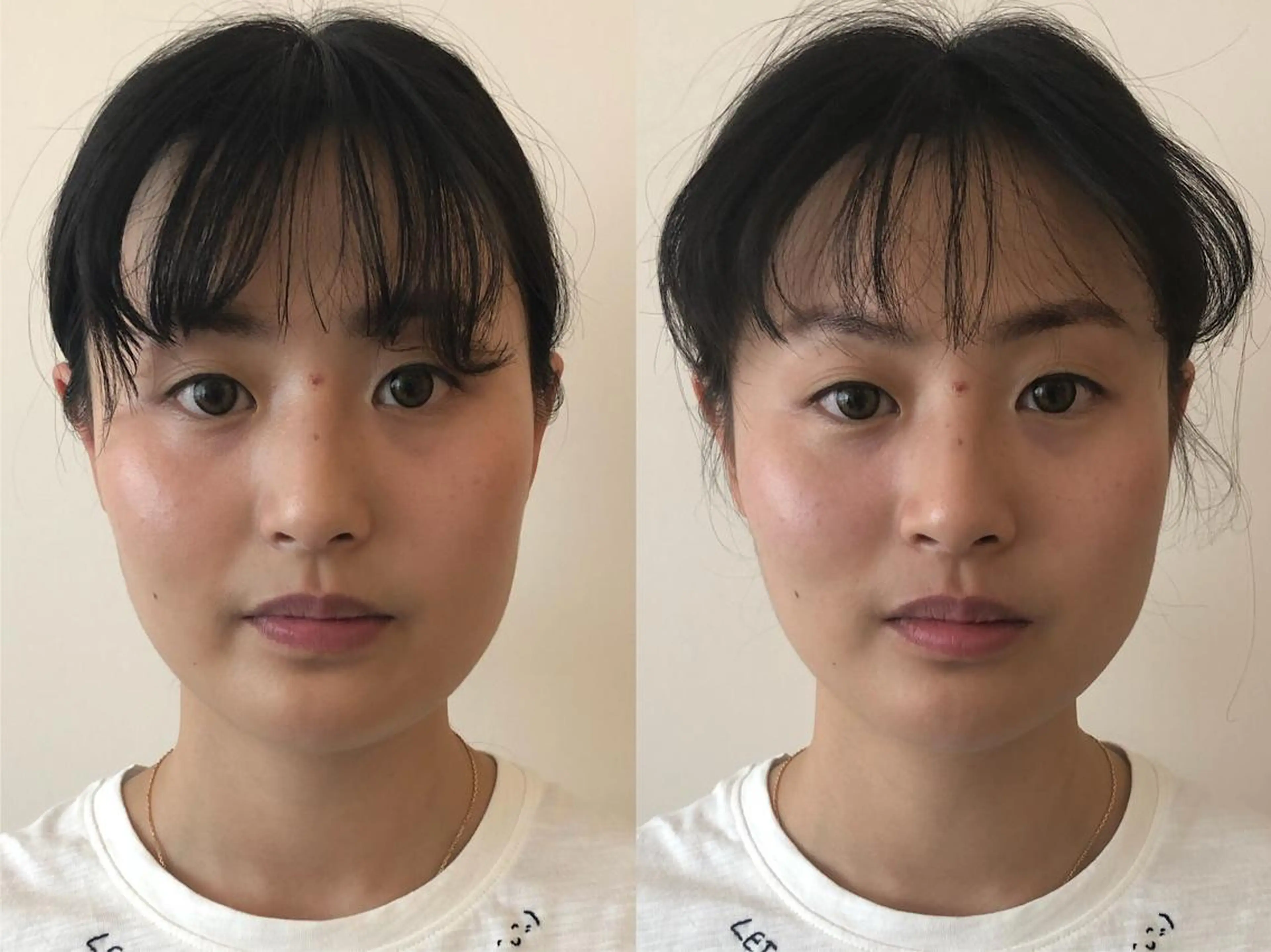 ショート 小顔カット 小顔矯正/美容整体 /骨盤矯正✨+Mi2のエステ・リラクイメージ