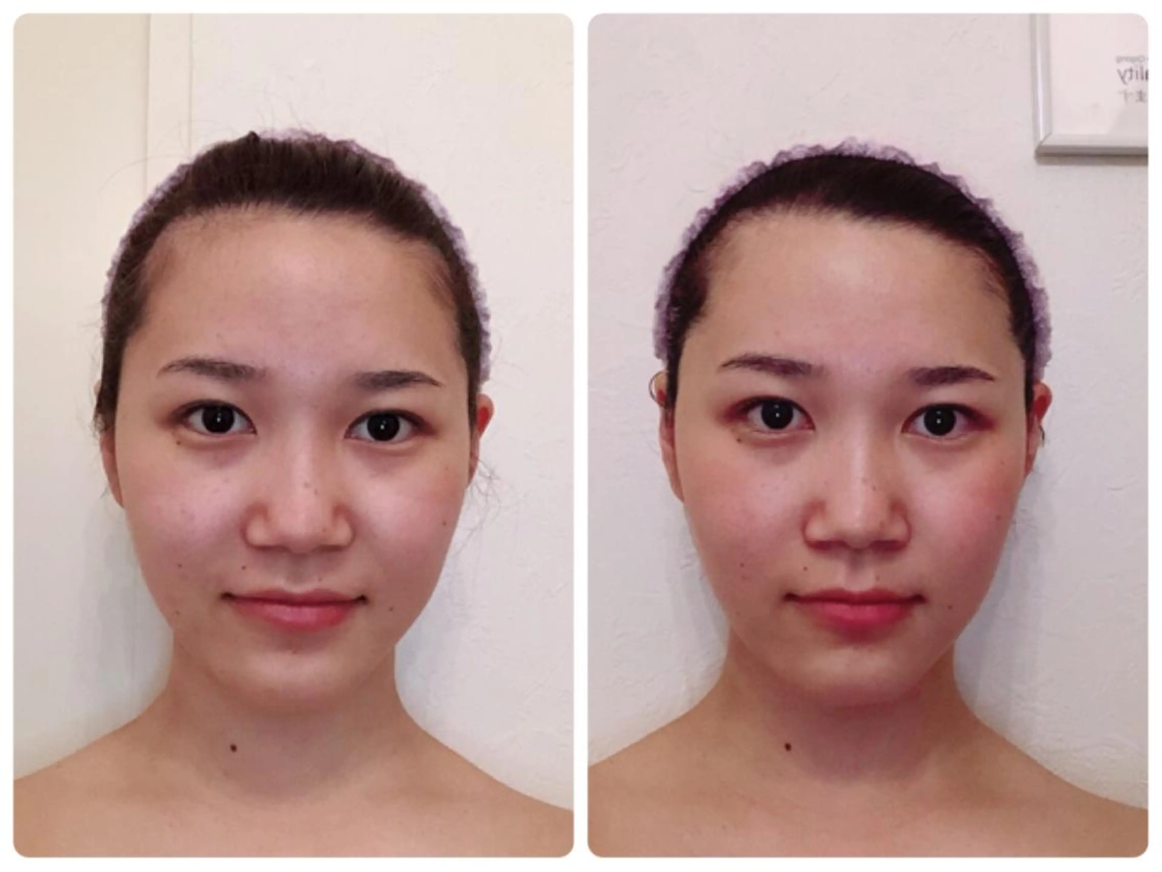 顔+デコルテ＋ヘッドセラピー(ツールなし)の写真