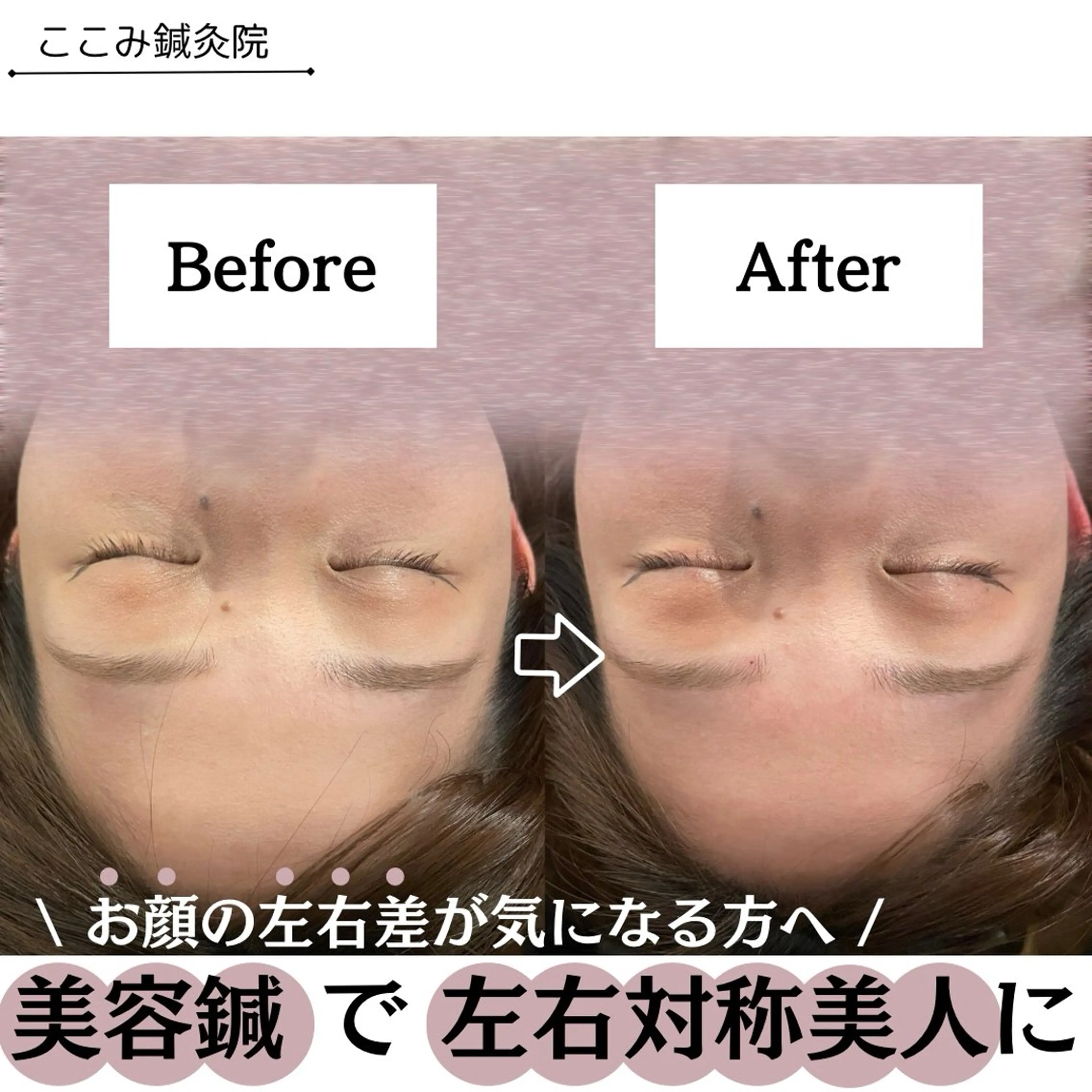 美容鍼/鍼灸 ここみ鍼灸院のエステ・リラクイメージ