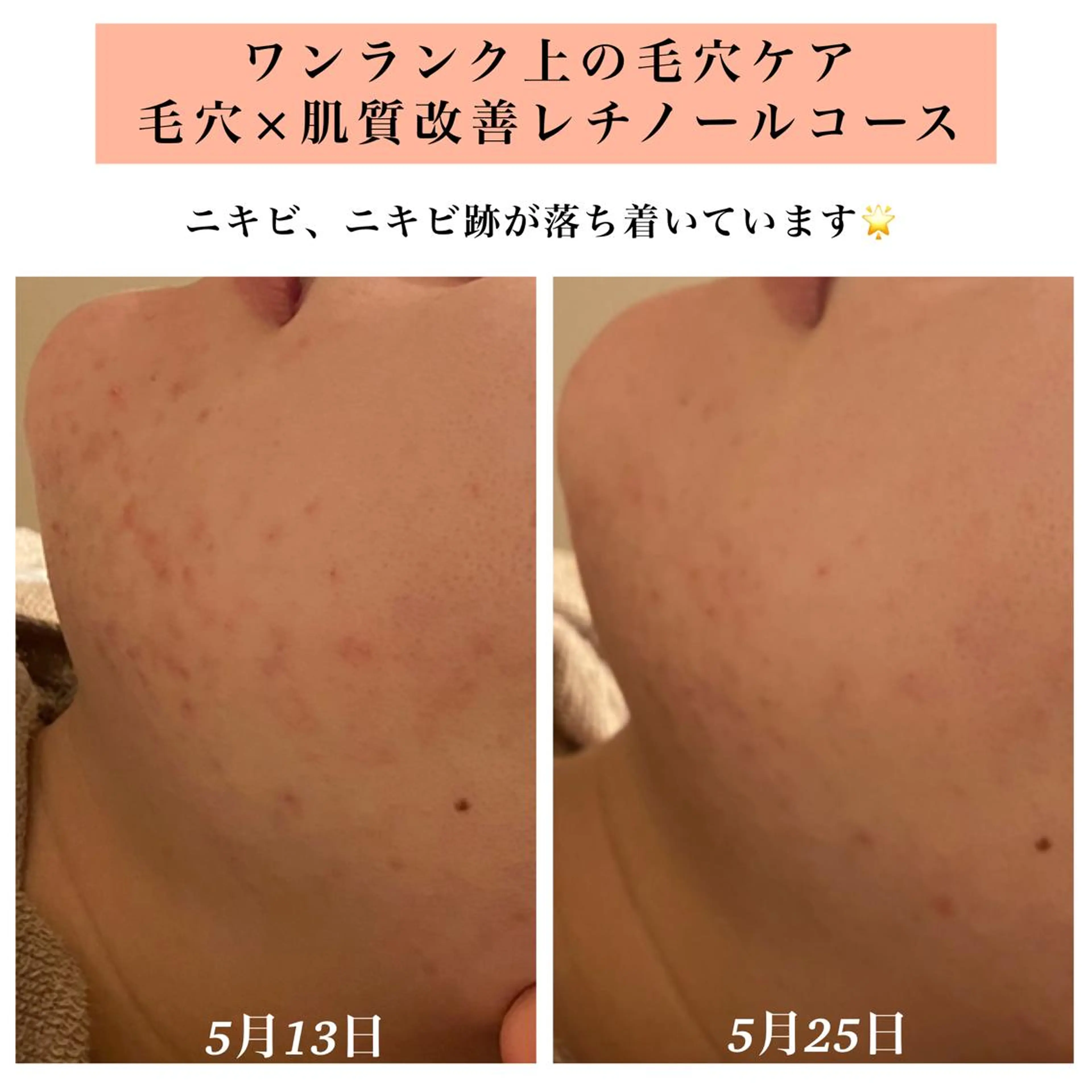 エステ リラク Bellesthe （ベルエステ）のエステ・リラクイメージ