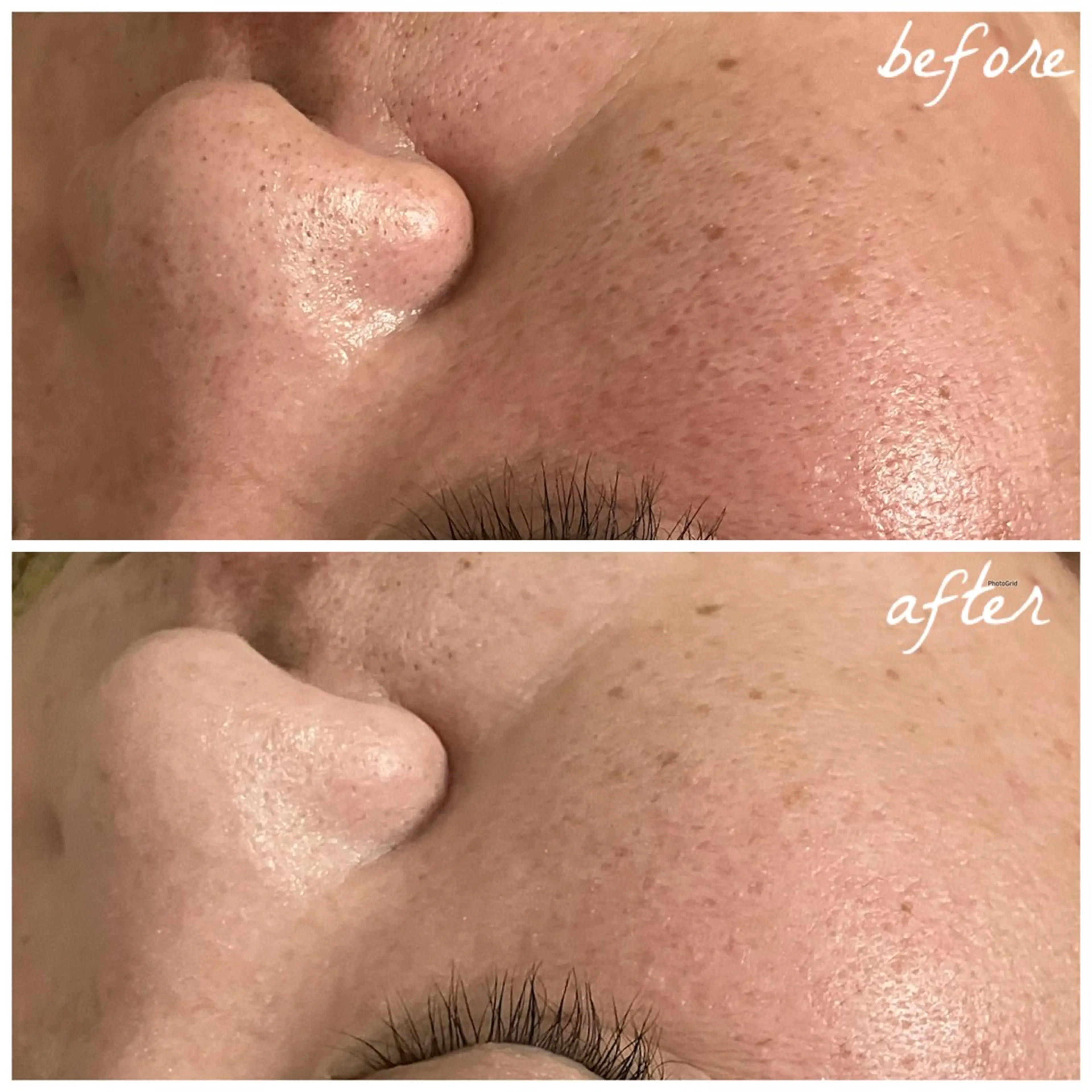 メンズ エステ メナード岐阜茜部 杉浦のエステ・リラクイメージ