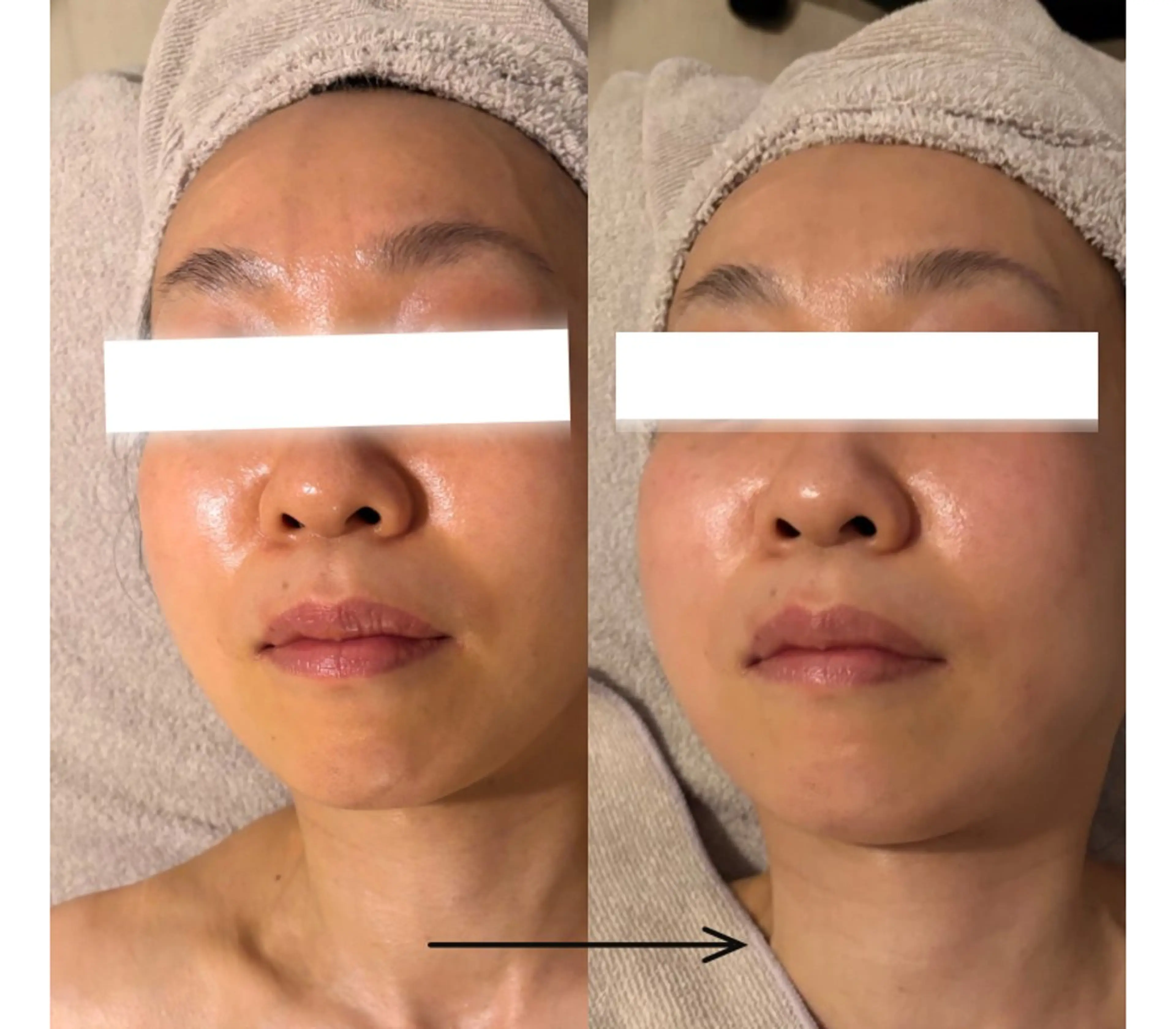 POLA THE BEAUTY 天王寺店所属・UEDA | POLA 天王寺のエステ・リラクイメージ