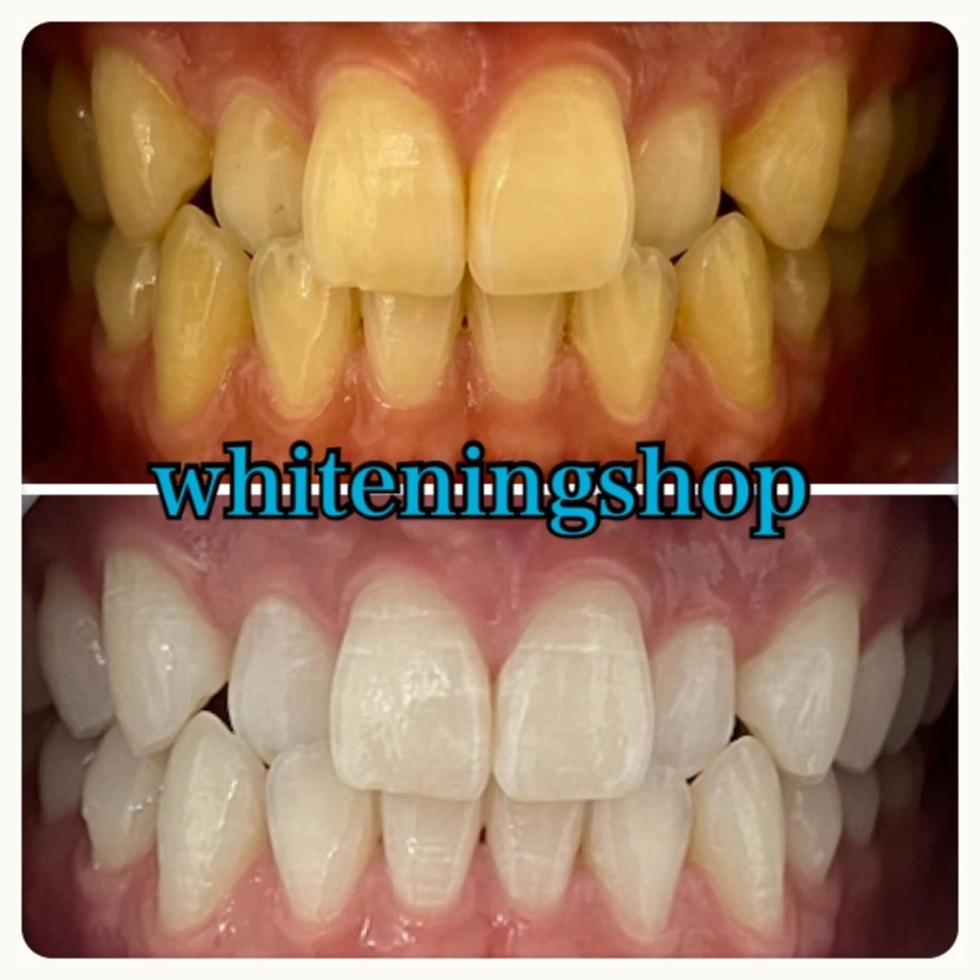 エステ リラク ホワイトニング ショップ吉祥寺店のエステ・リラクイメージ