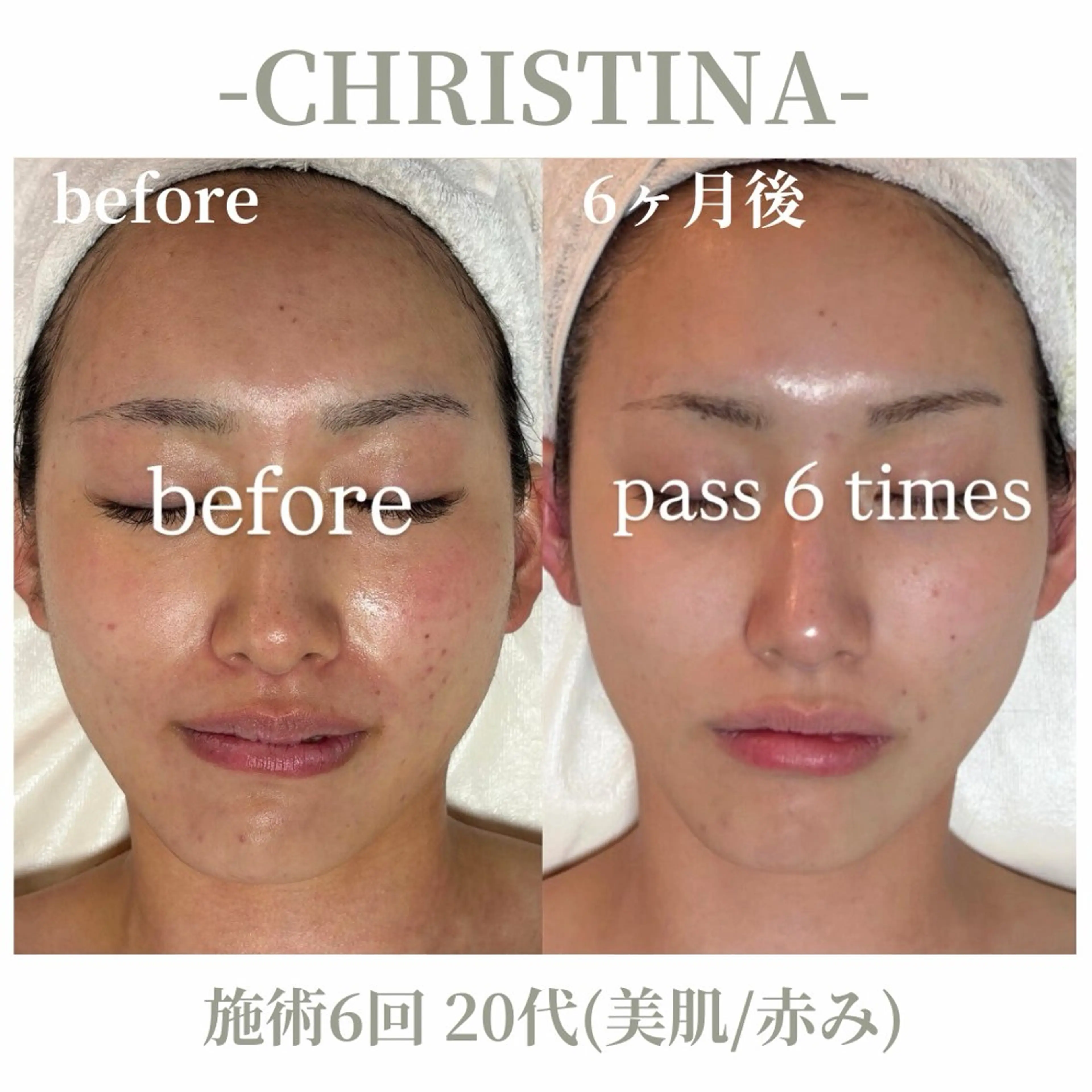 エステ 肌質改善|天王寺 For...はるかのエステ・リラクイメージ