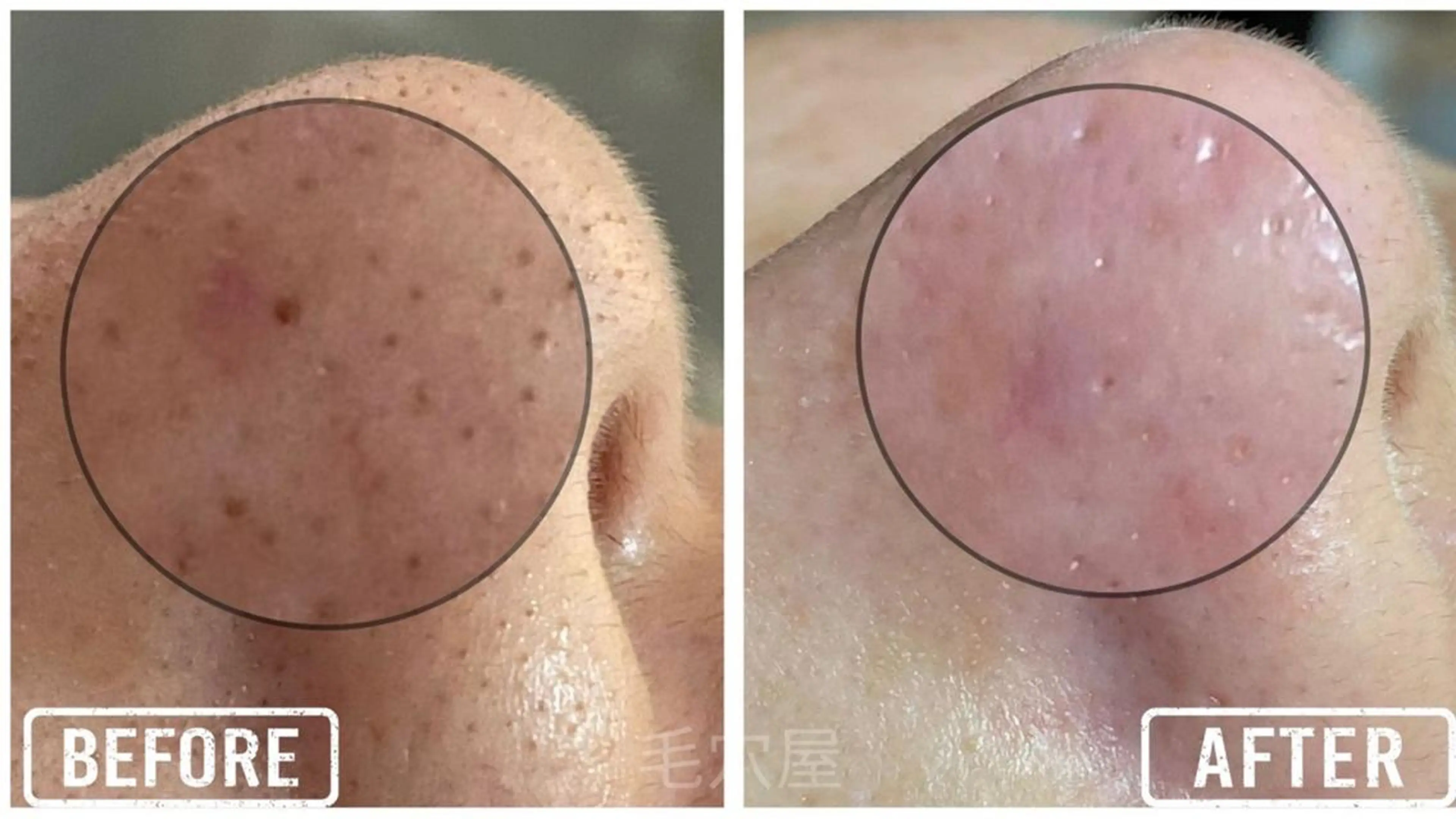 エステ 毛穴/毛穴洗浄専門 エミルカ船橋のエステ・リラクイメージ