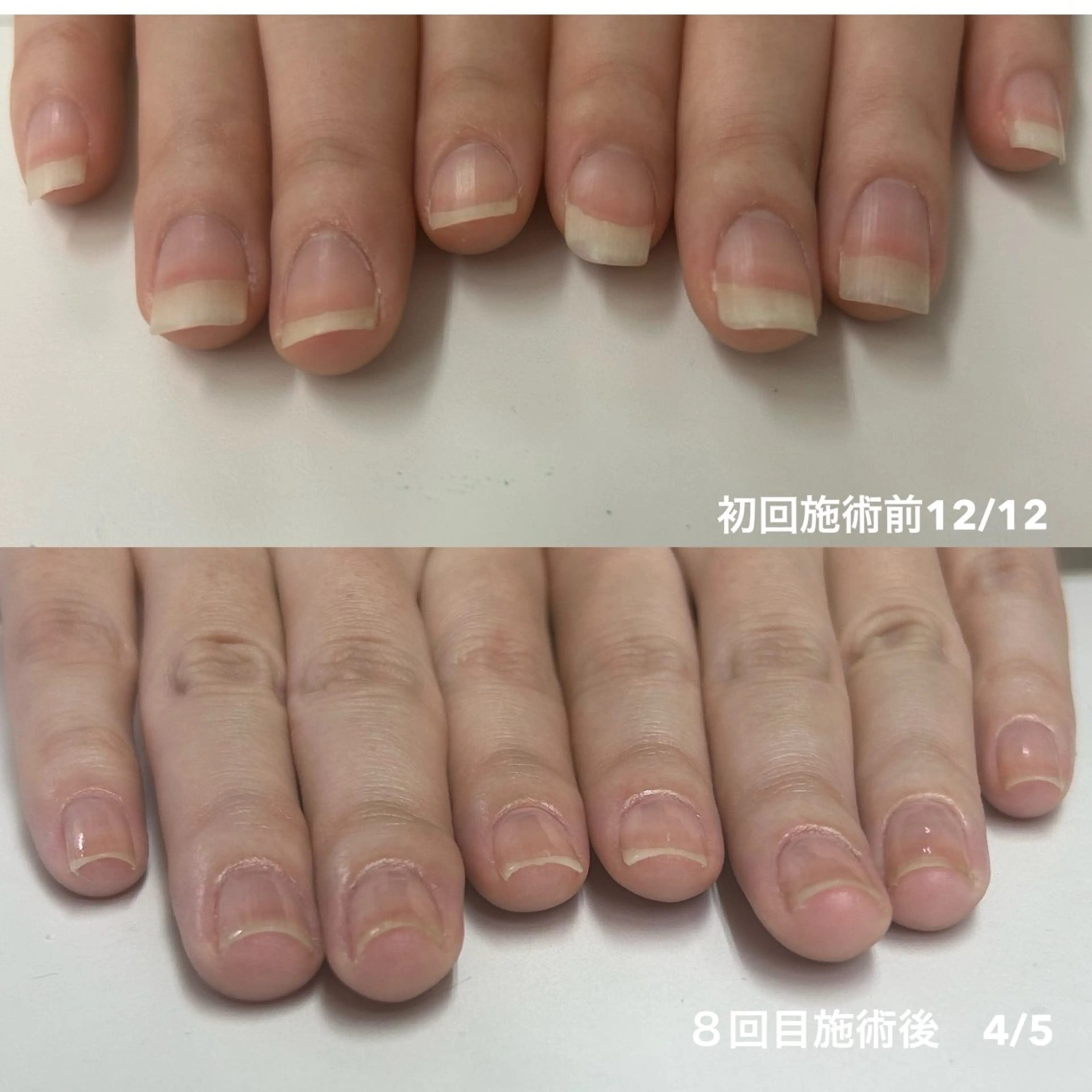 ネイル nail salon ikuneのネイルデザイン