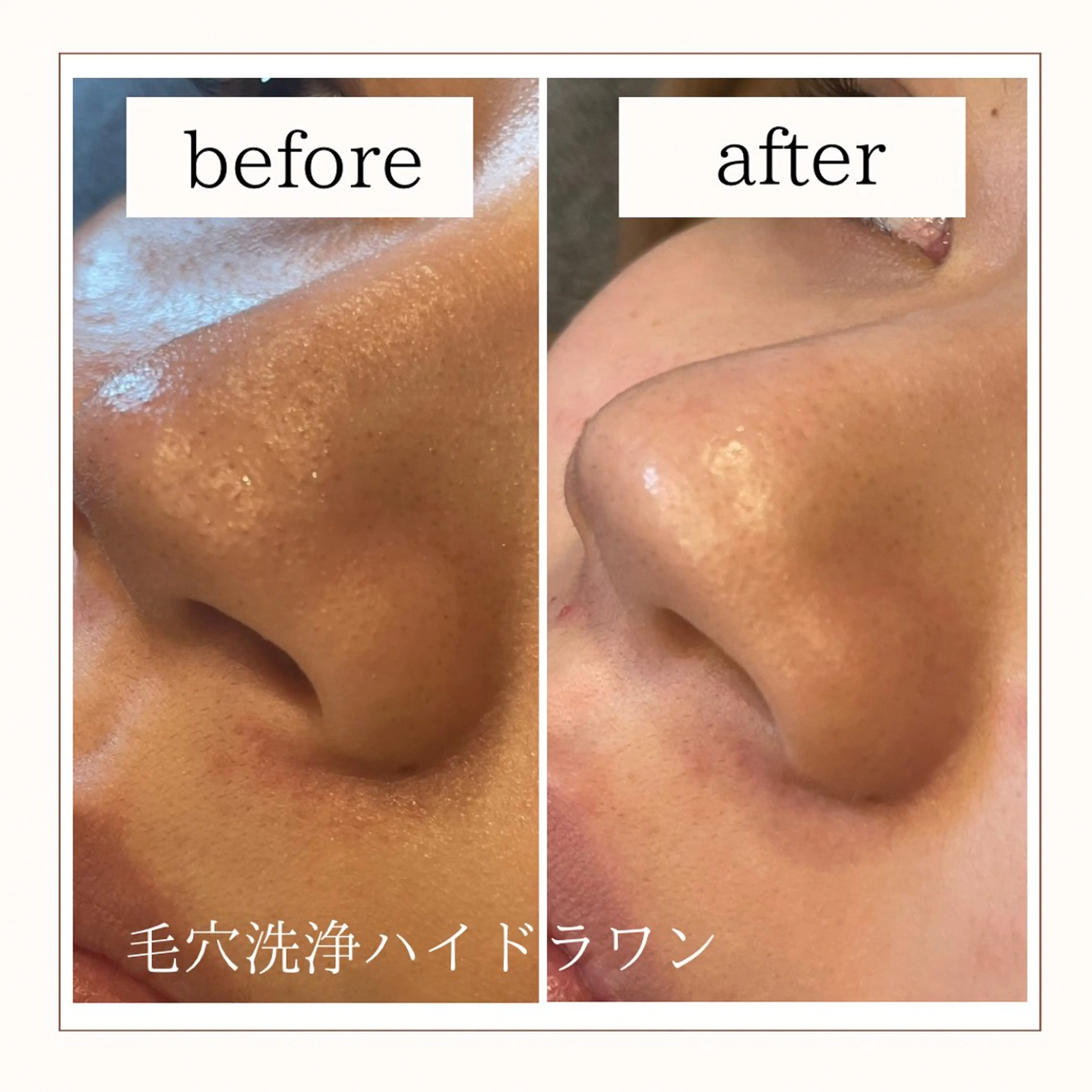 その他 Reid-月詠-所属・Reid -月詠-のエステ・リラクイメージ