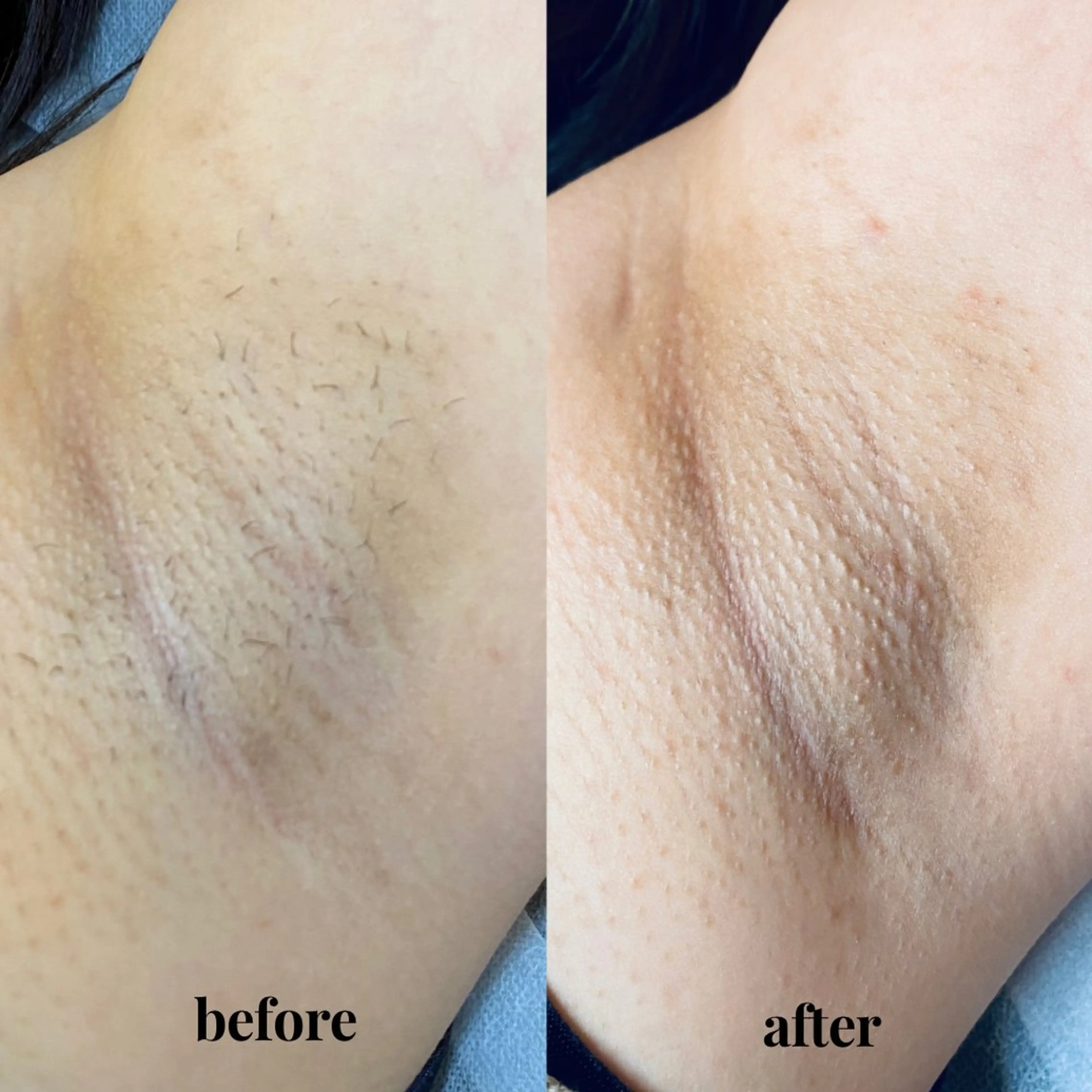 脱毛 シュガーリング 【MARLS】の眉毛・アイブロウイメージ