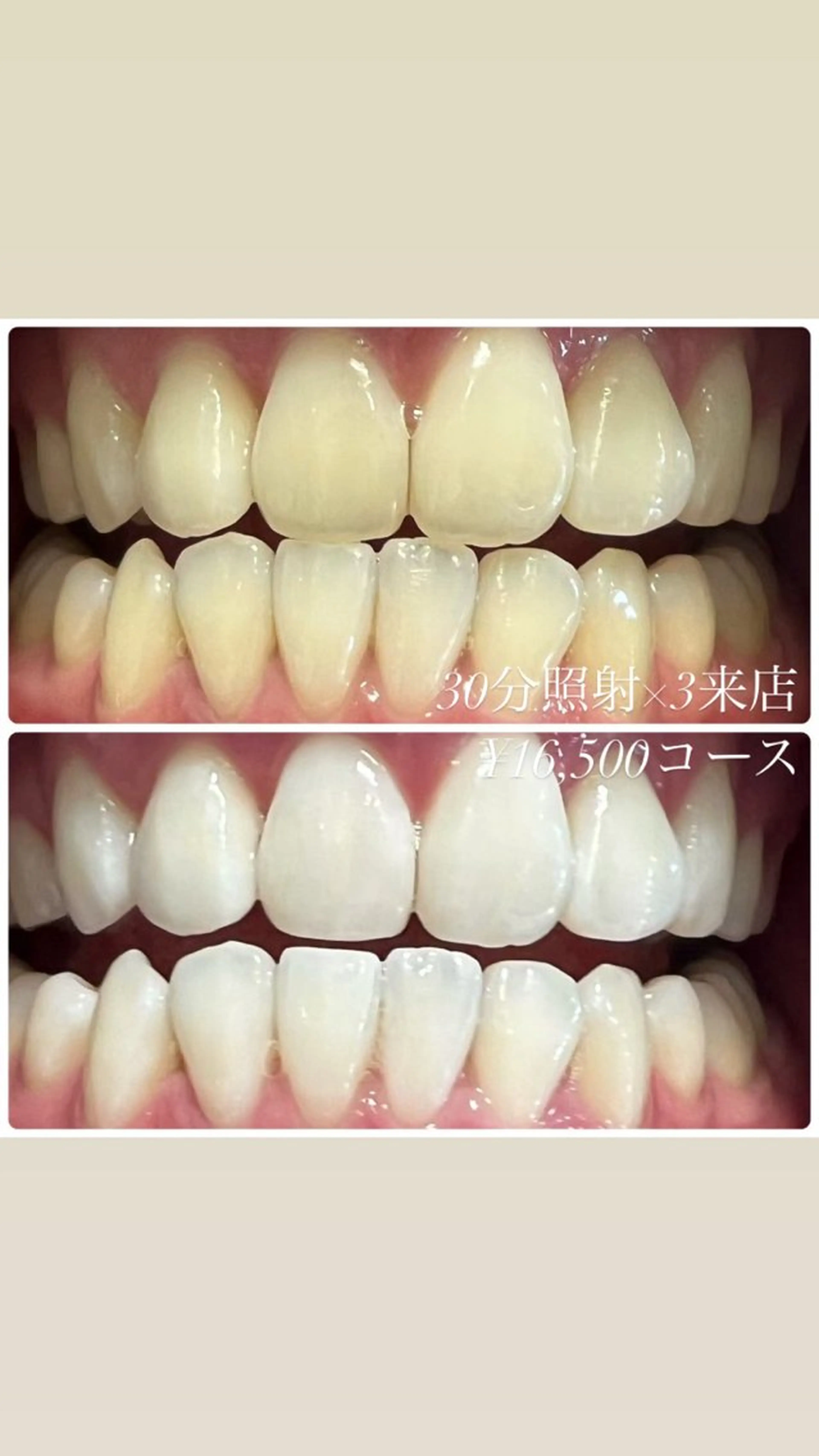 その他 ホワイトニングルーム　川崎店所属・ホワイトニング ルーム　川崎店のその他イメージ