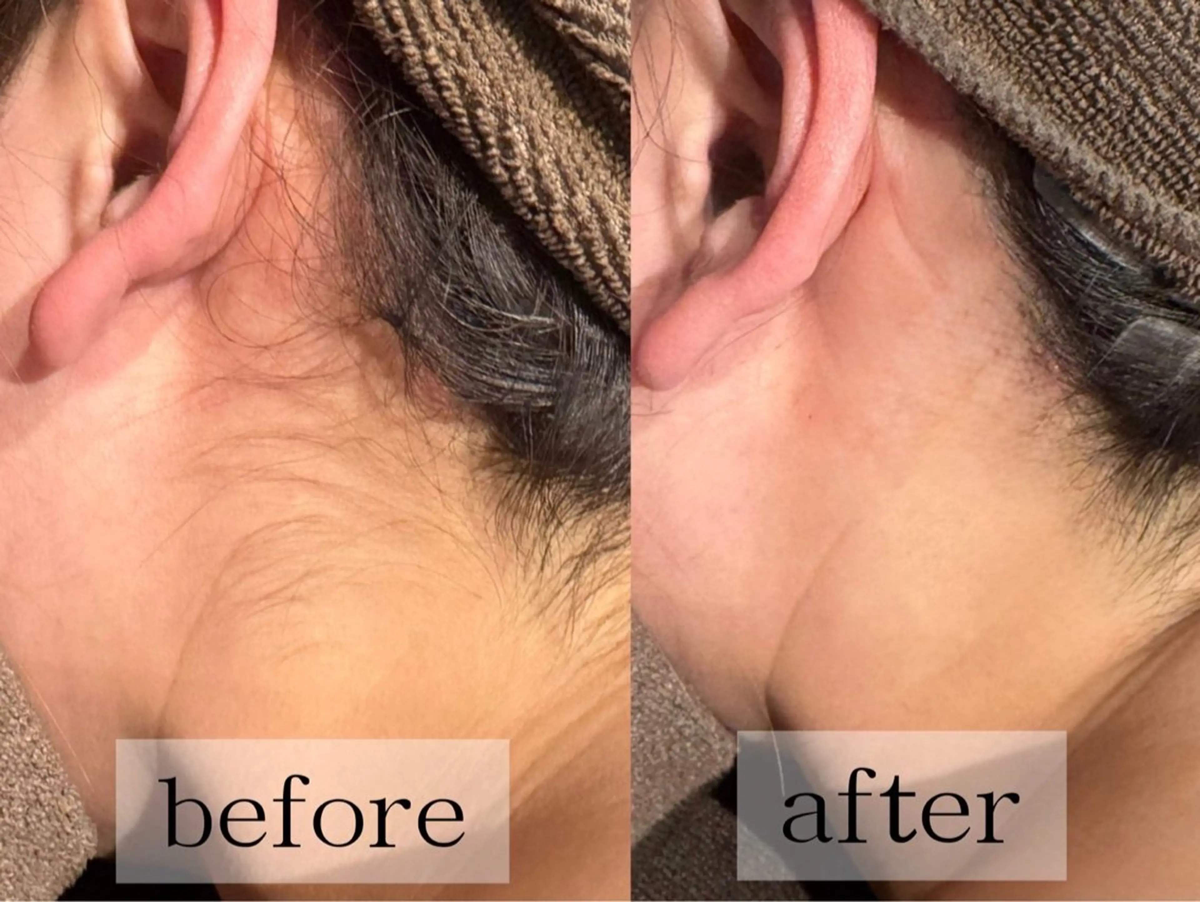 毛穴・肌質ケア専門 グランビューティーのエステ・リラクイメージ