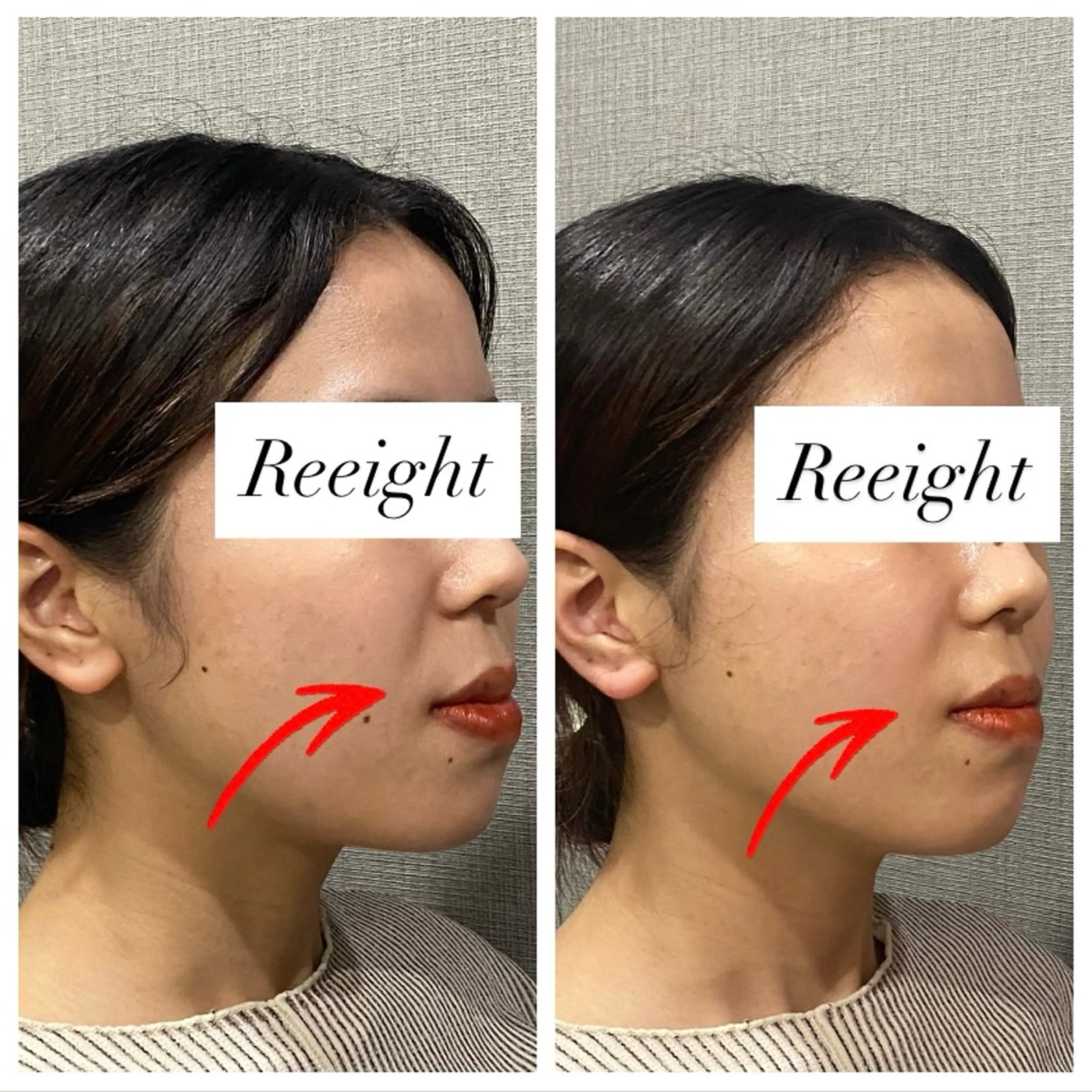 エステ 肌質改善専門 ハーブ /毛穴洗浄 リエイトのエステ・リラクイメージ