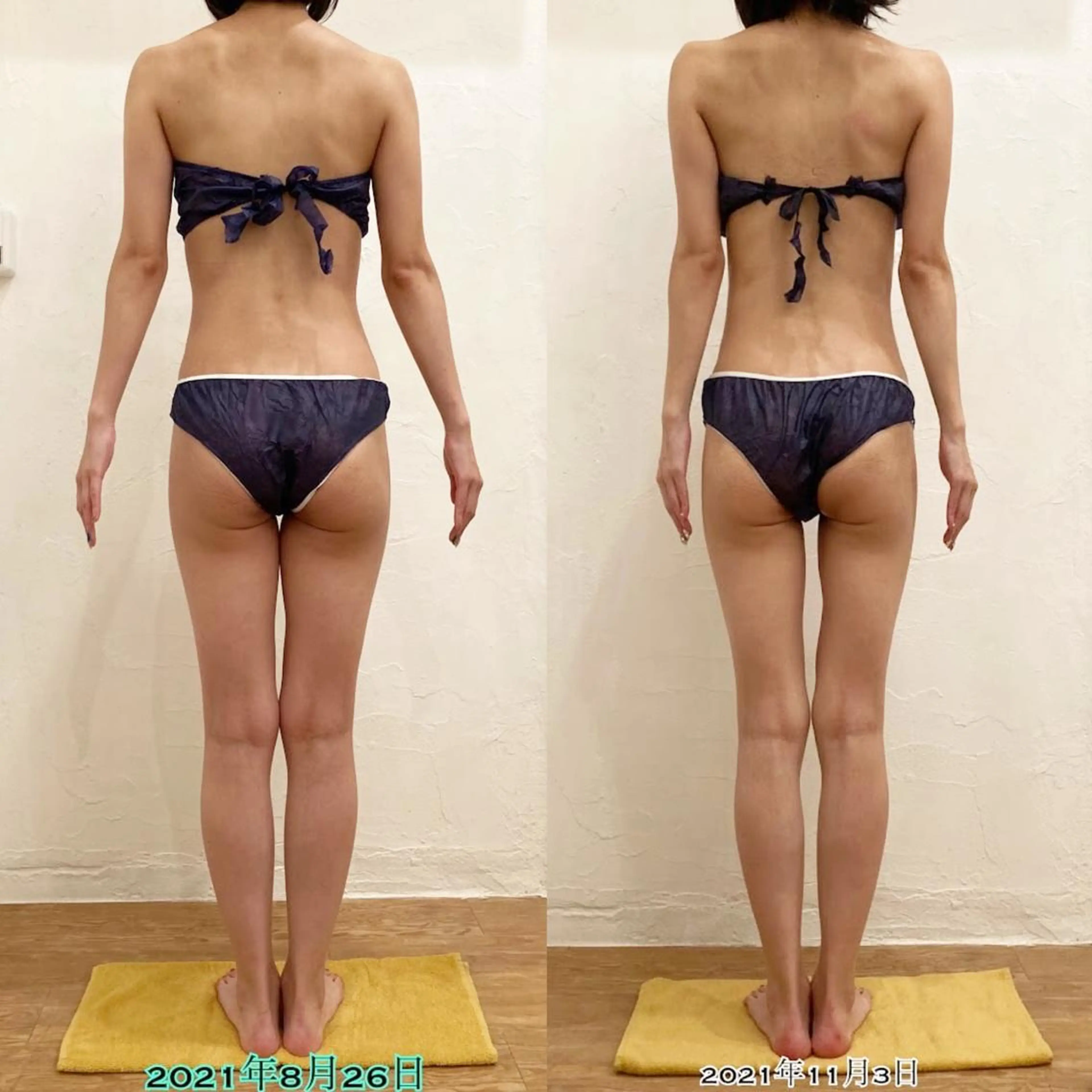 【ご褒美エステ90分】全身がっつり痩身❣️🙆‍♀️#痩せたい＃癒されたい#肩凝り#太もも#二の腕#ぽっこりお腹#ヒップの写真