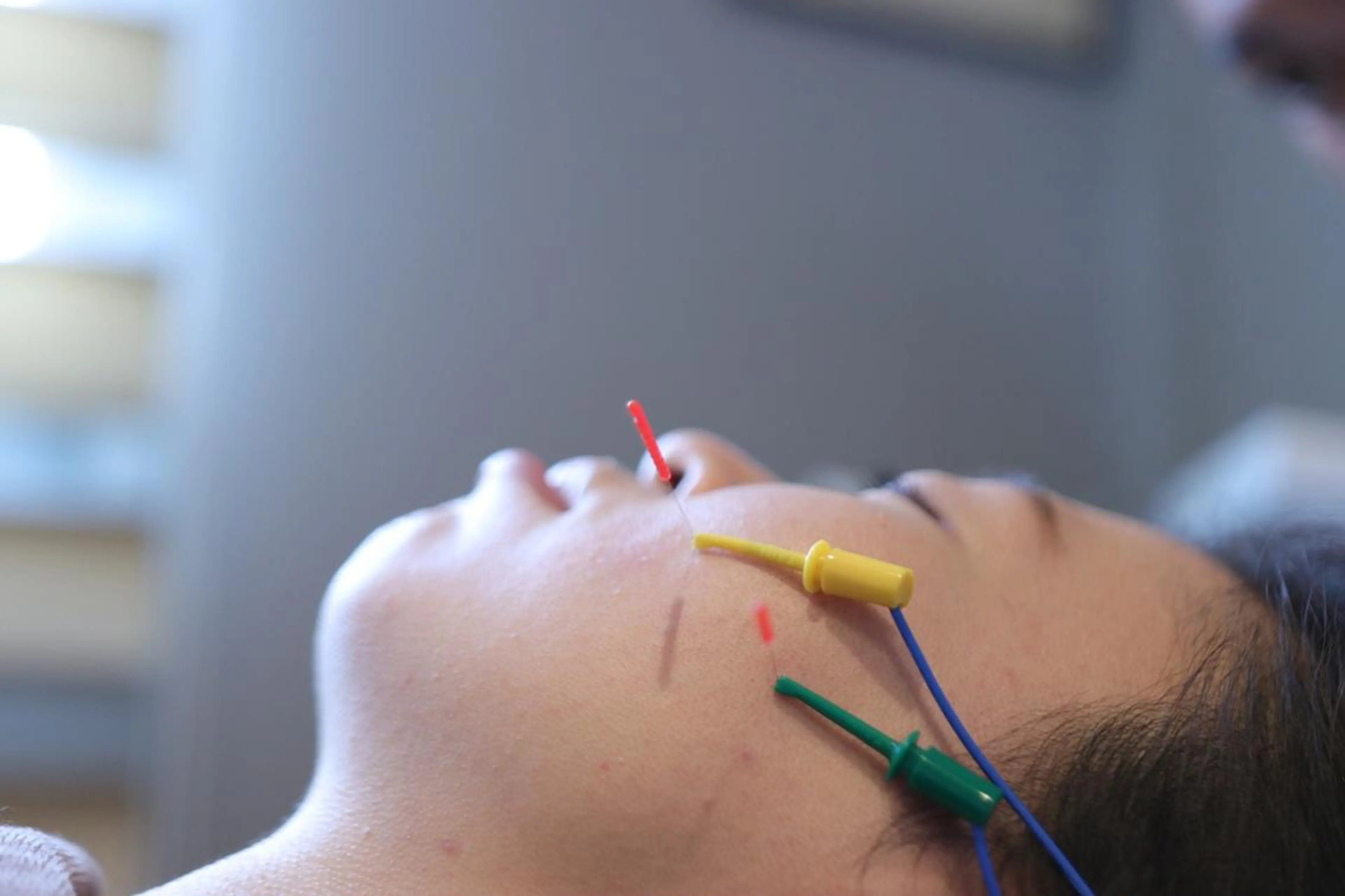 美容とカラダの鍼灸 サロン やなけんのエステ・リラクイメージ