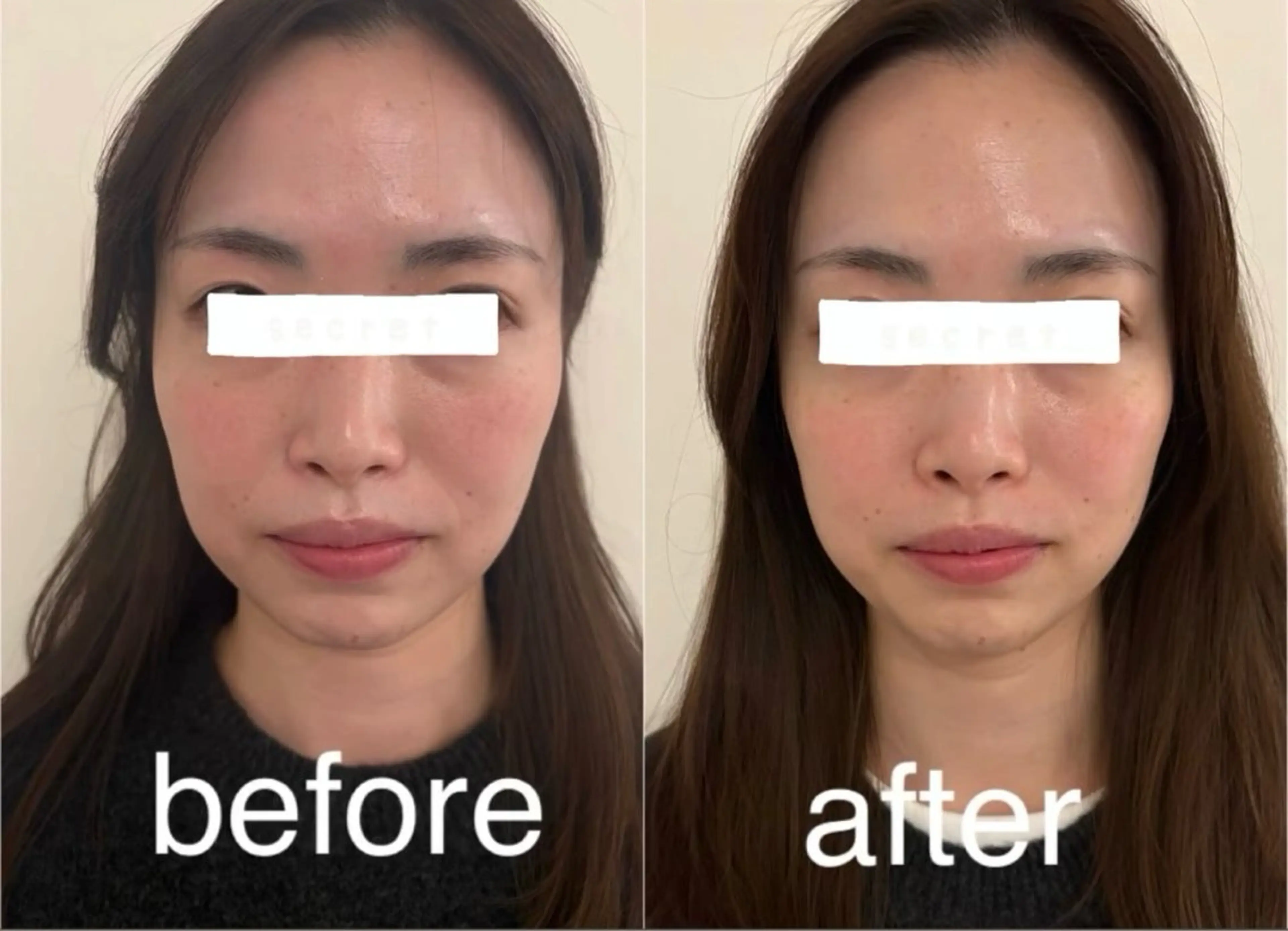 エステ リラク 美容鍼灸サロン mahoroba院長のエステ・リラクイメージ