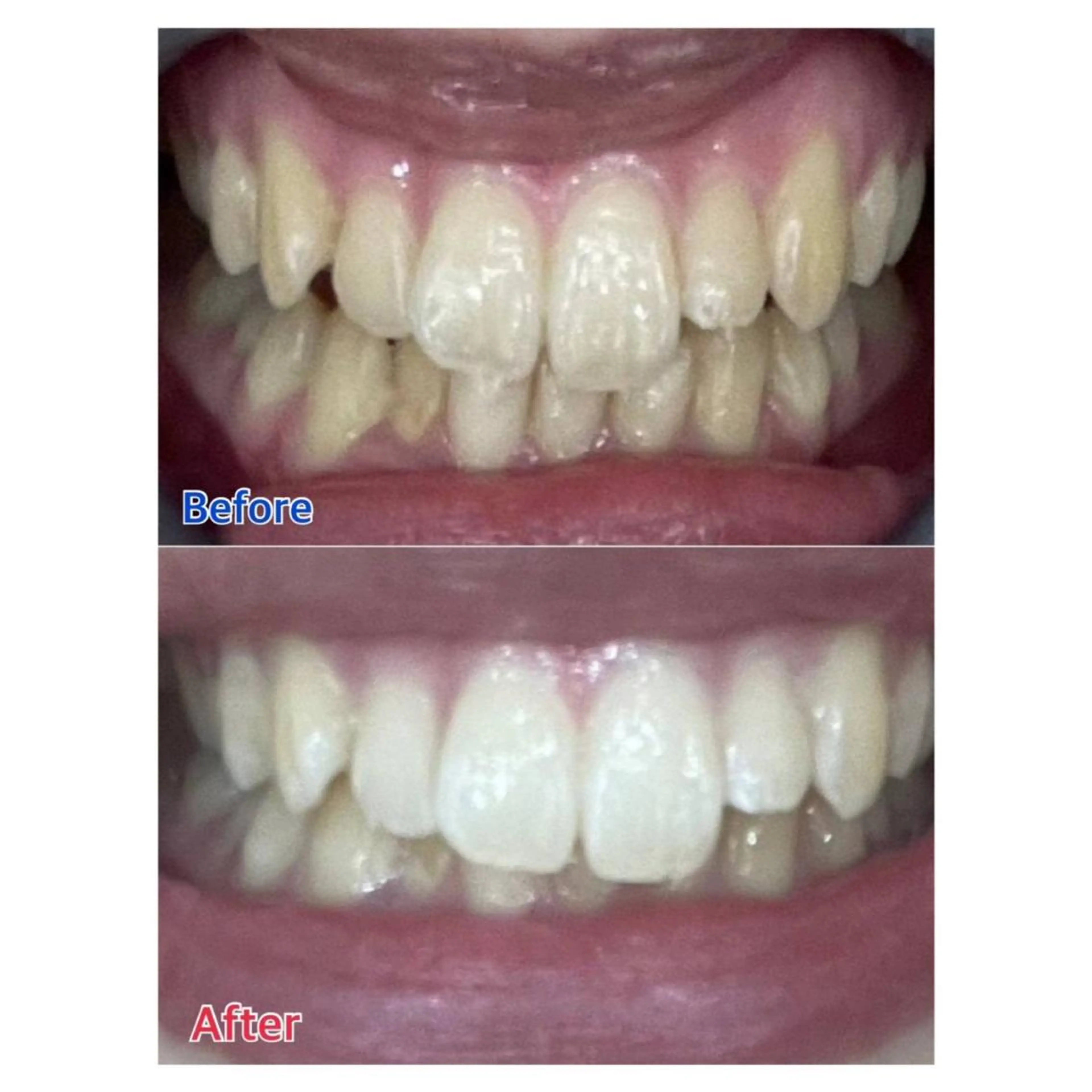 MBEAUTYSALON 千葉店・京成大久保所属・Melty 輝のその他イメージ