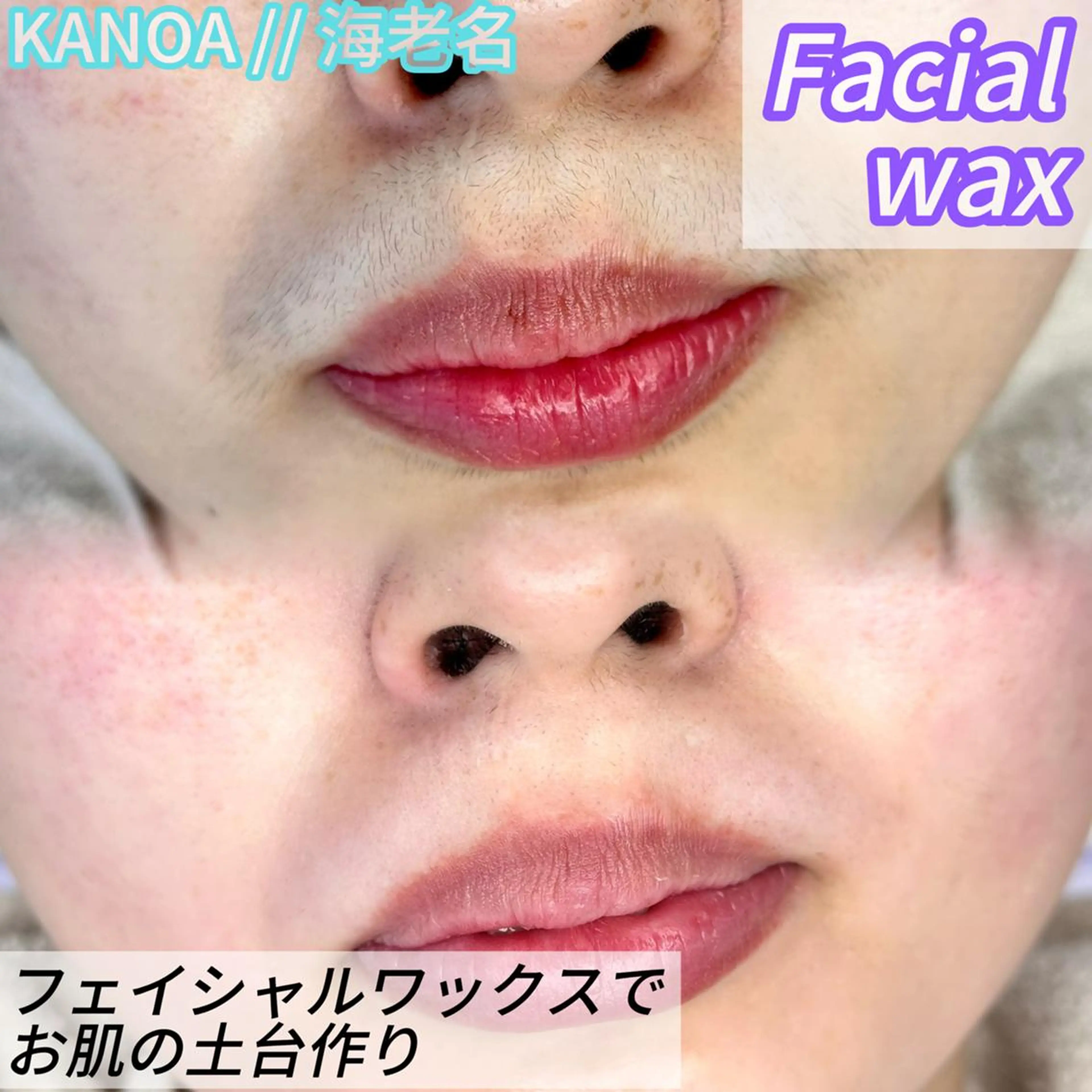 フェイシャルワックス脱毛の写真