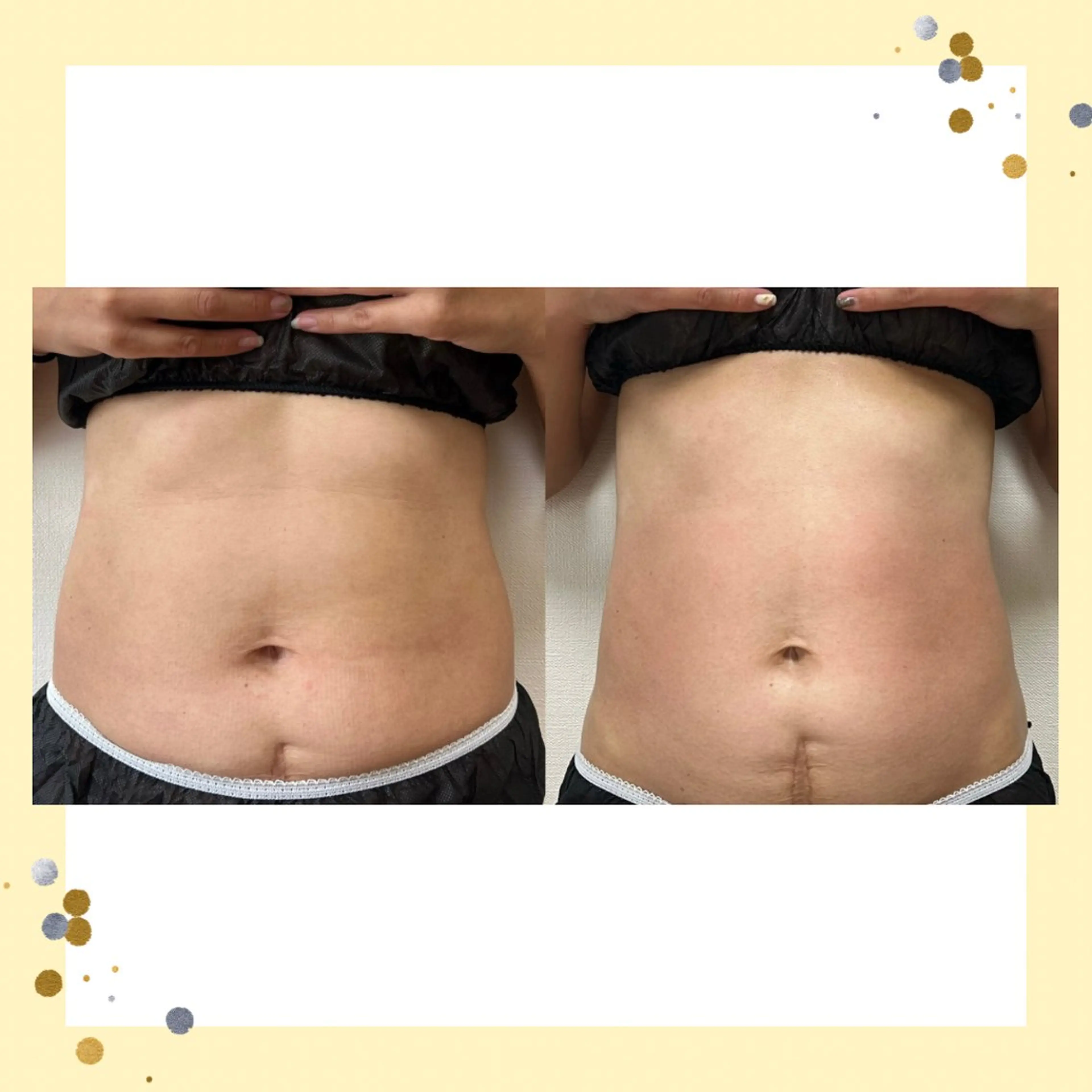 Beauty   Salon  Adiy所属・Adiy ikumiのエステ・リラクイメージ