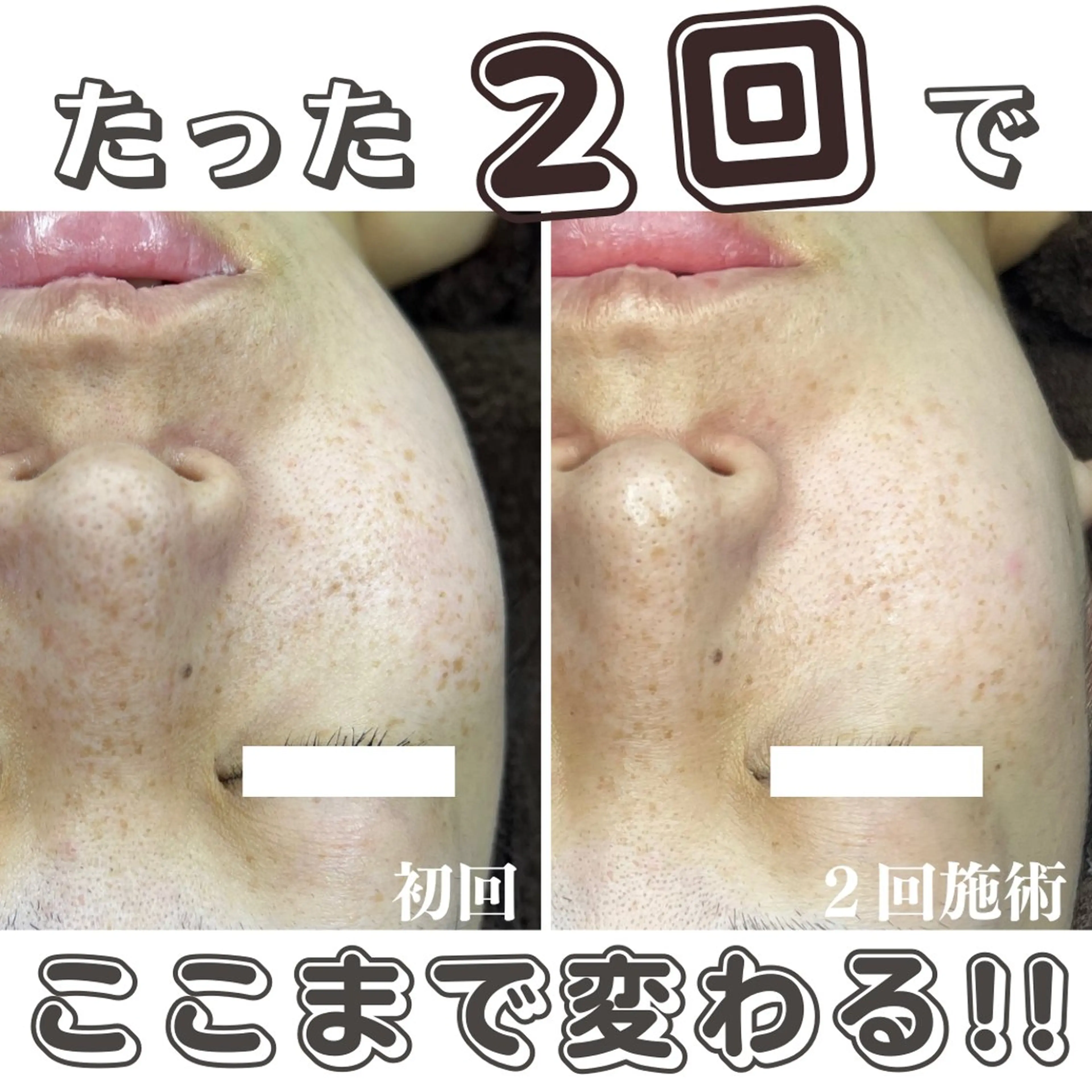 最新シミケアLily de pearlのエステ・リラクイメージ