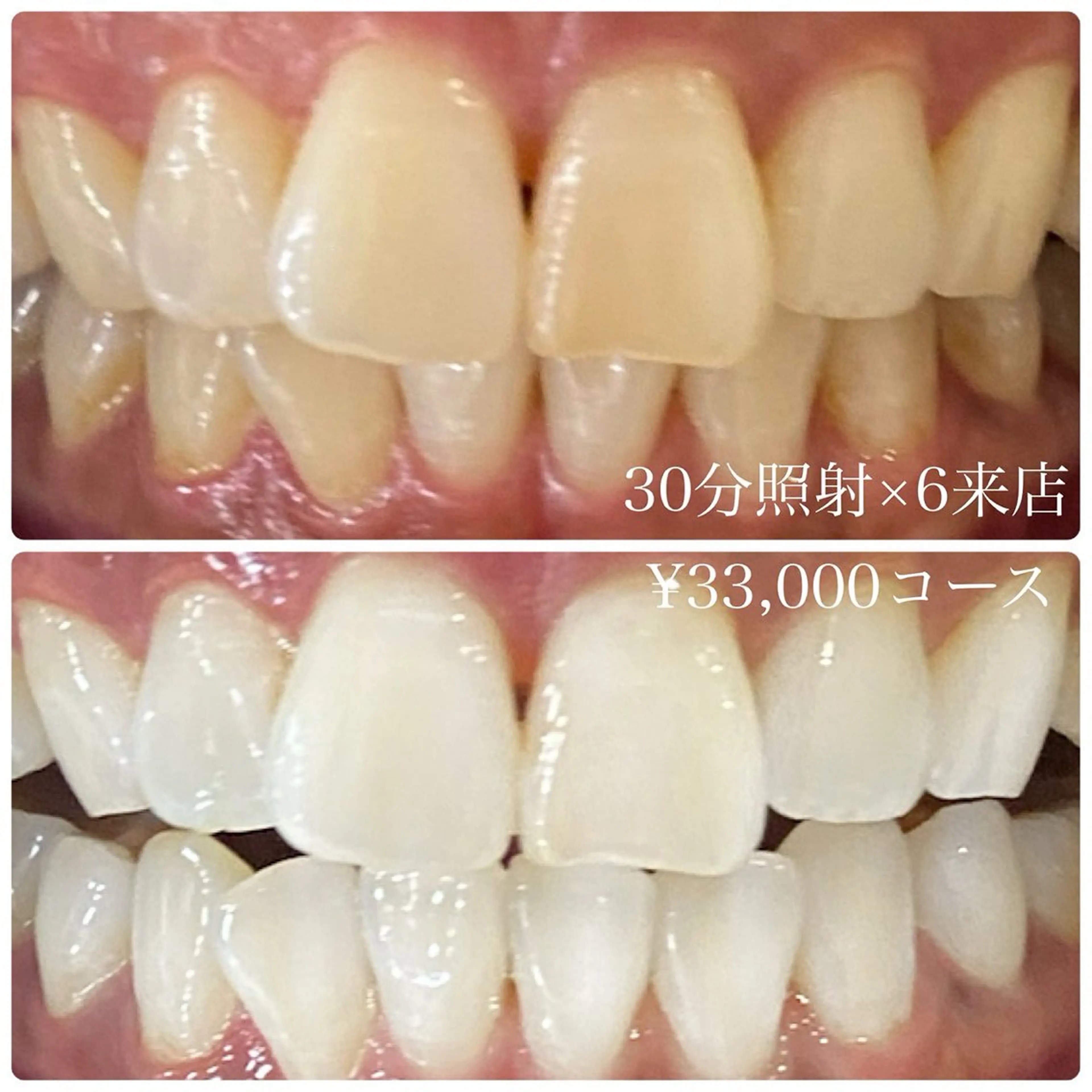 PLATINUM Beauty 横浜店所属・ホワイトニングルーム 横浜店のその他イメージ