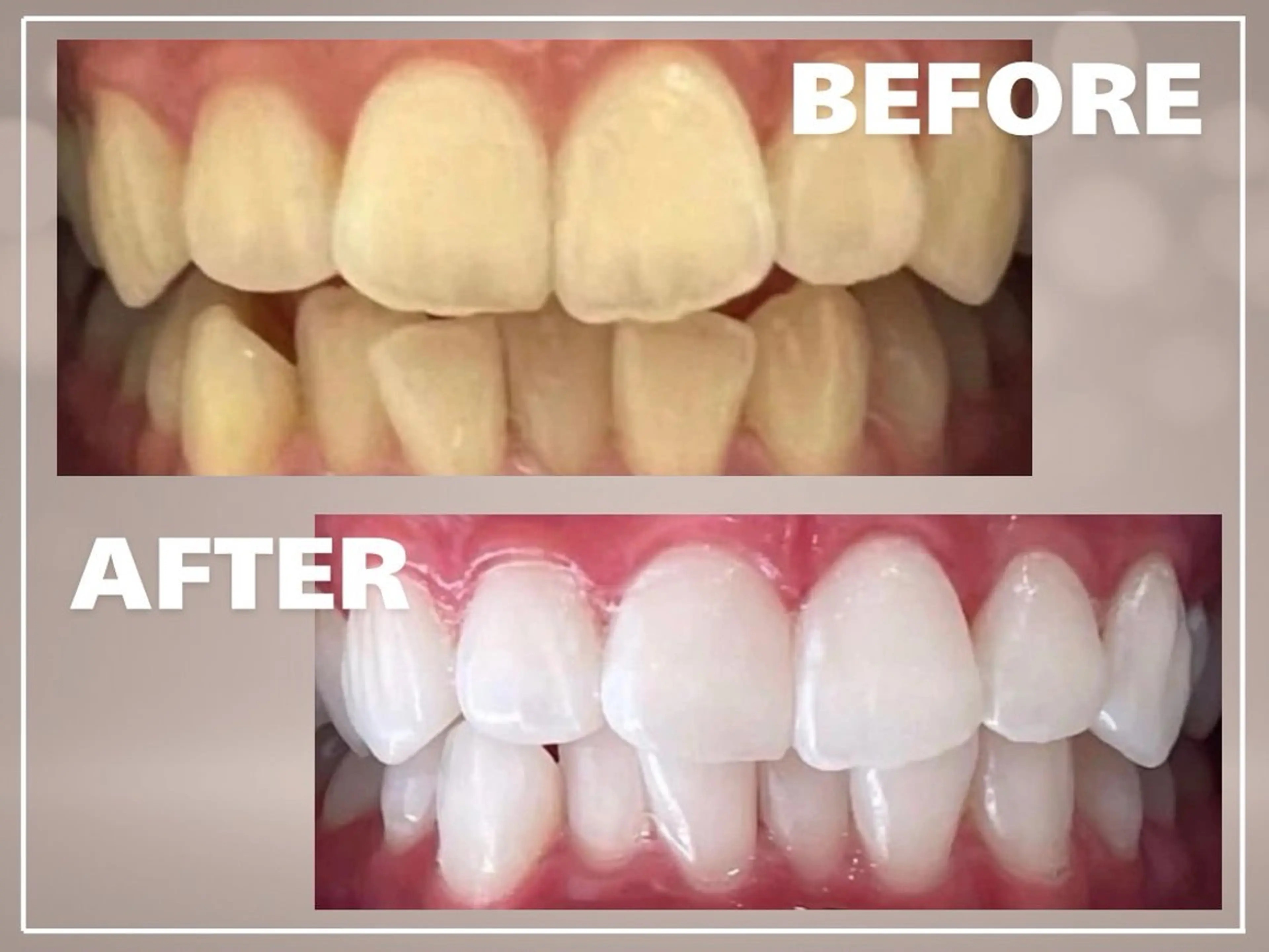 ホワイトニング ショップ銀座7丁目店のその他イメージ