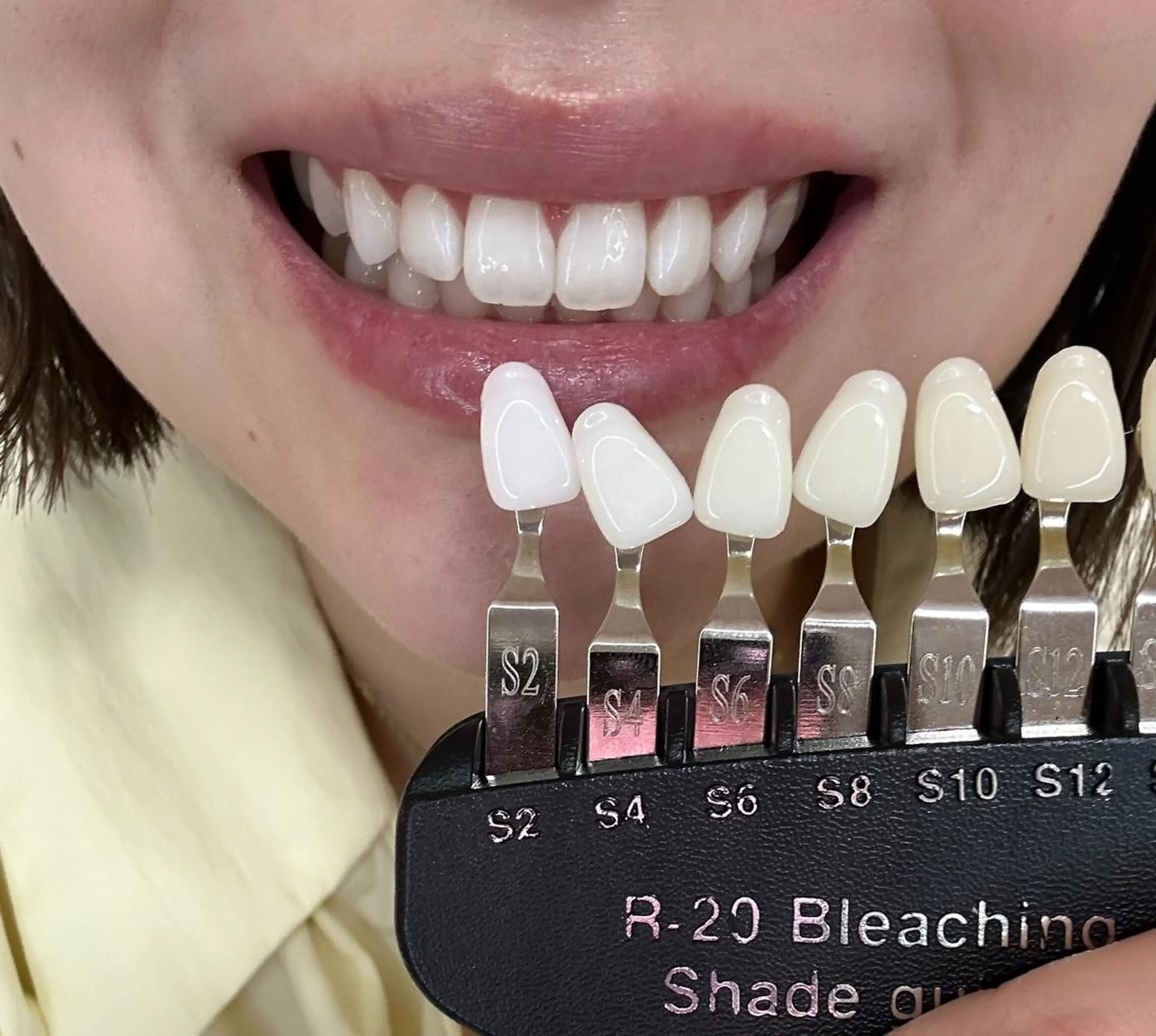 Whitening Carat 恵比寿店所属・ホワイトニング カラット 恵比寿店のエステ・リラクイメージ