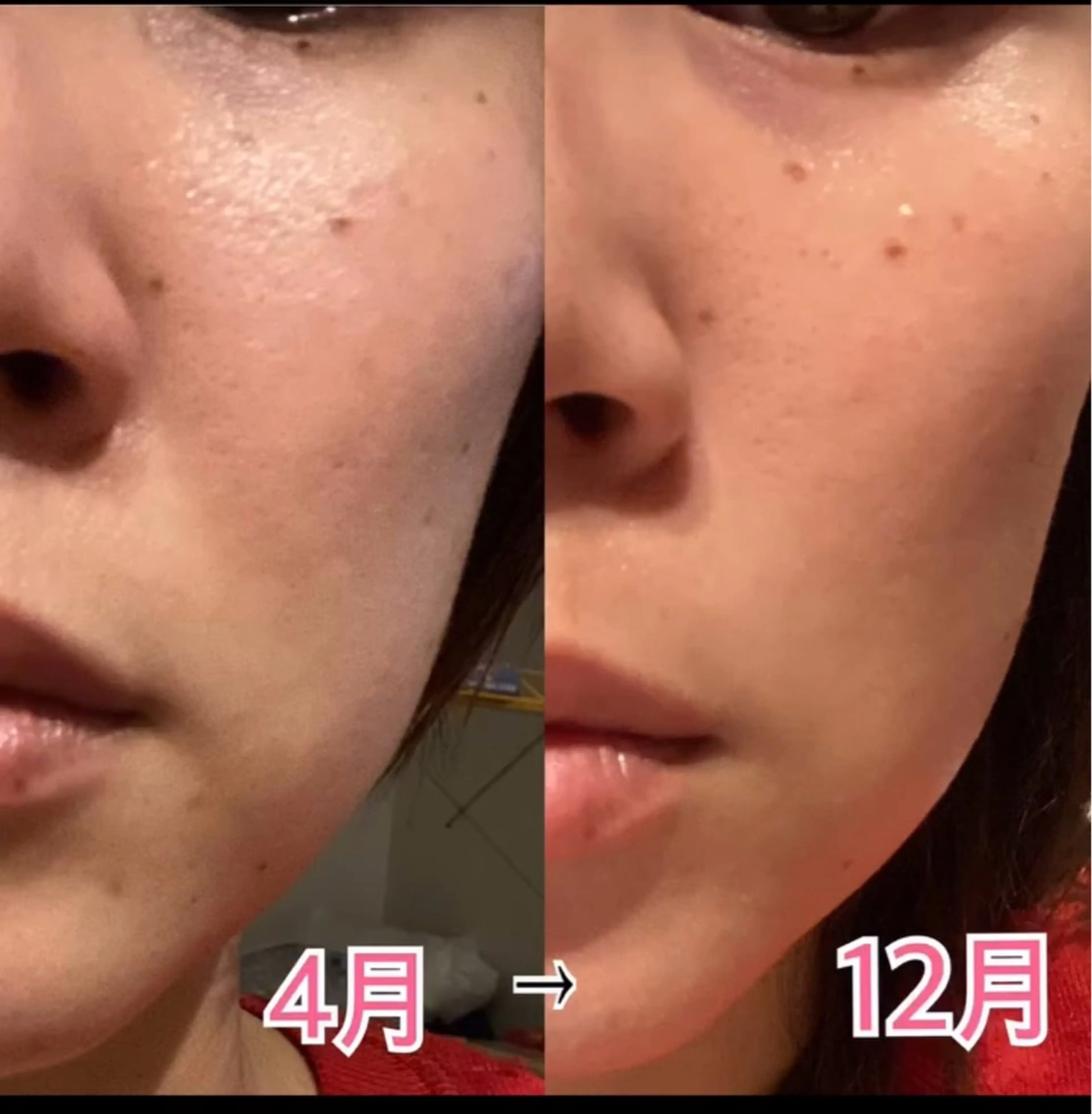 エステ ビューティーサロン　プリズム所属・久留本 茜のエステ・リラクイメージ