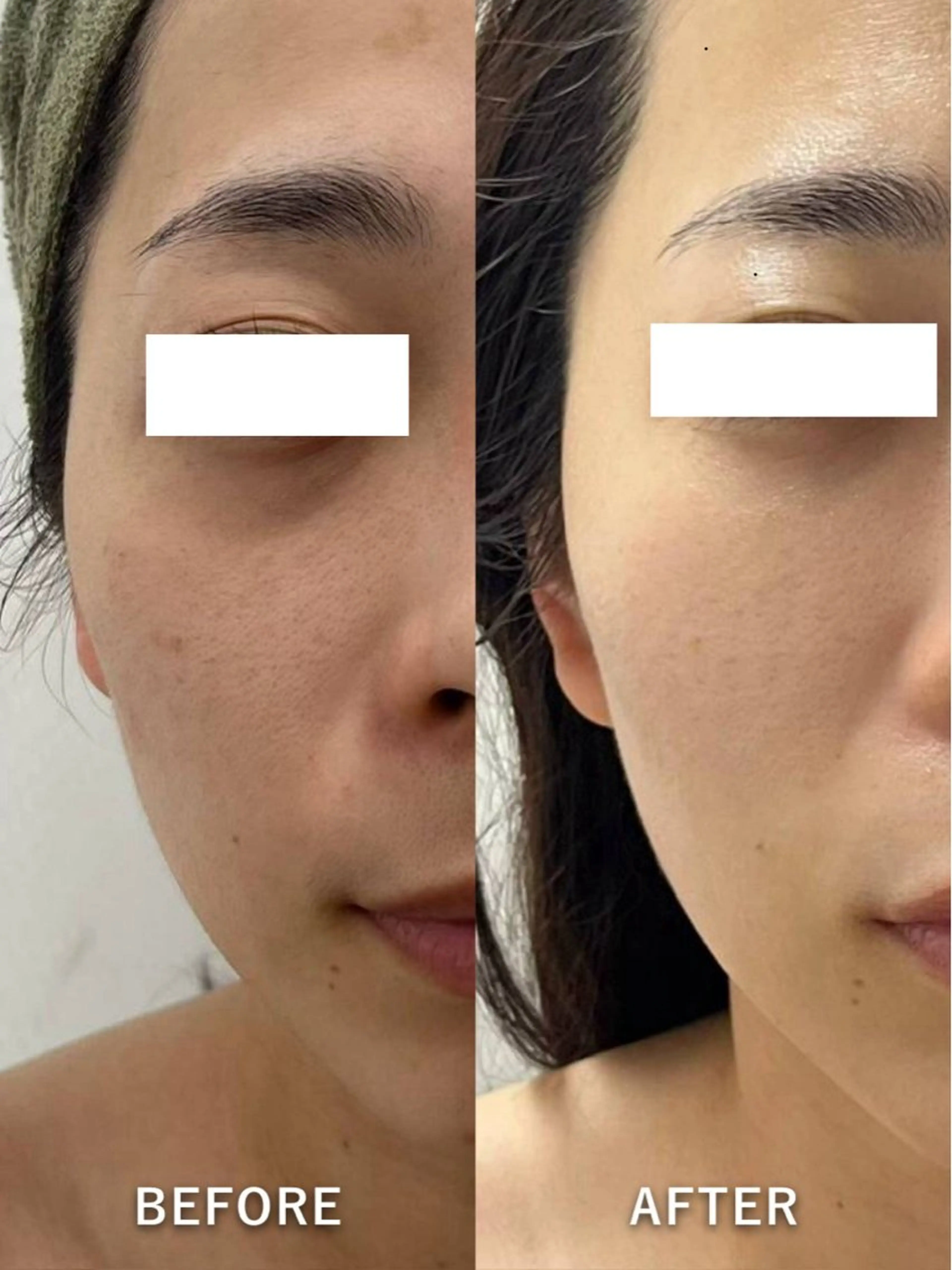 エステ 韓国美肌/肌質改善 【天神】yuiのエステ・リラクイメージ