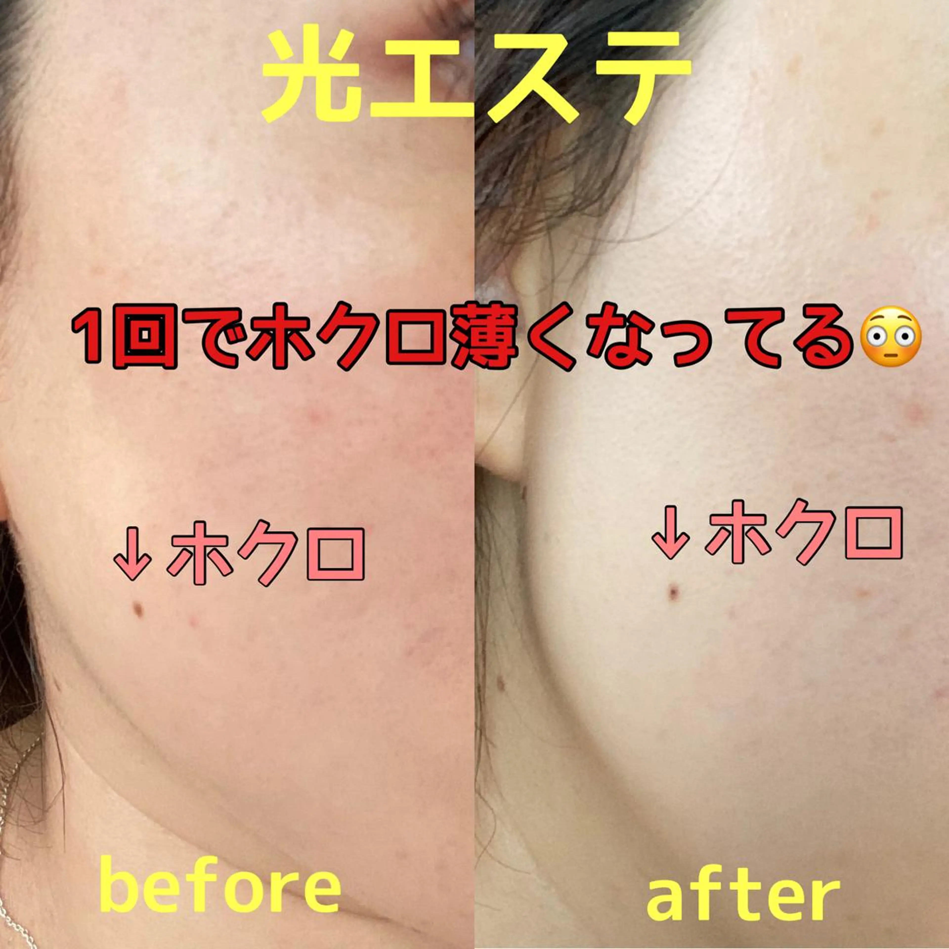 Rim リムのマツエク・マツパデザイン