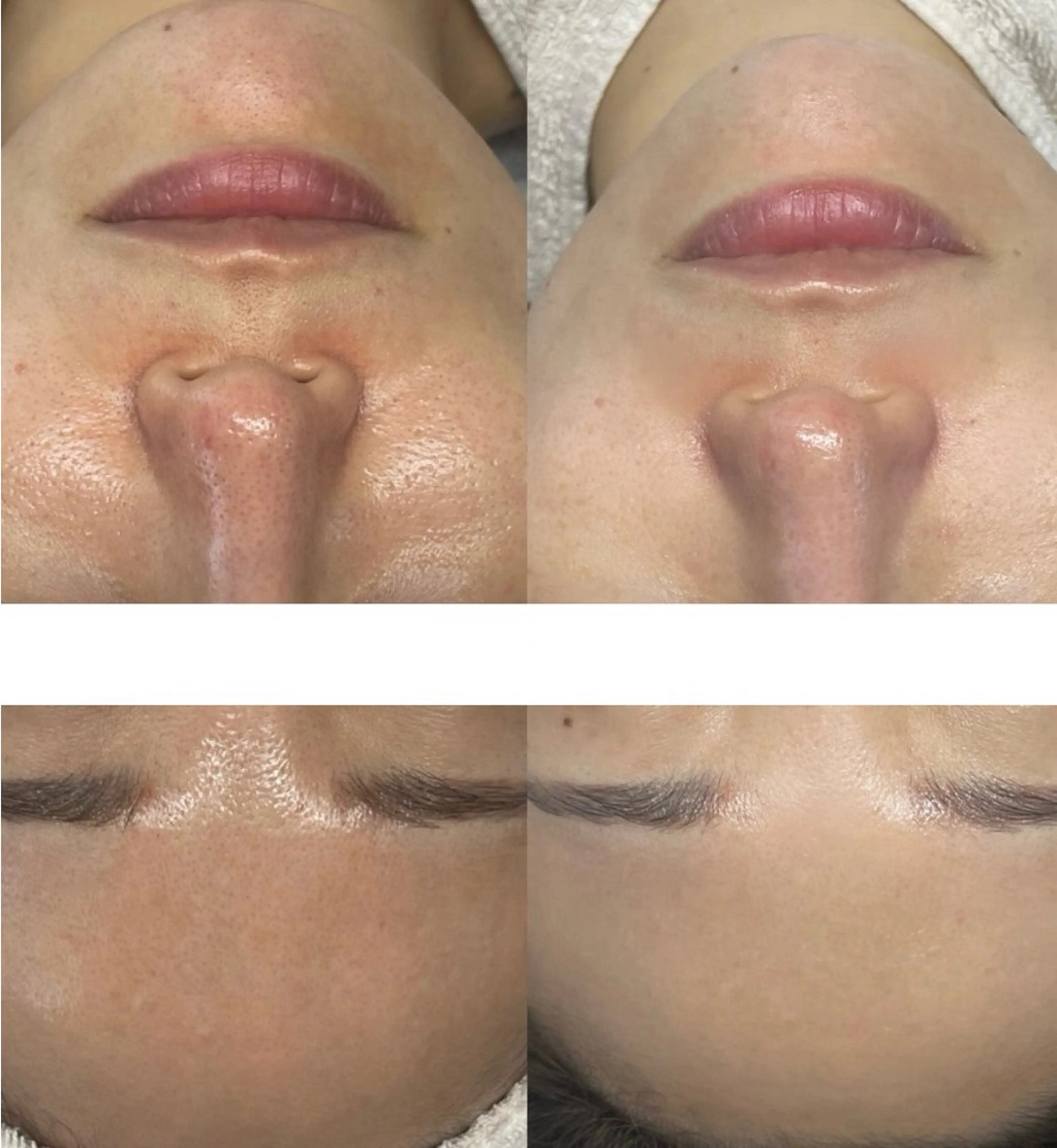 脱毛 DahliaBeauty ダリアビューティー所属・Dahlia 痩身 フェイシャル 中村のエステ・リラクイメージ