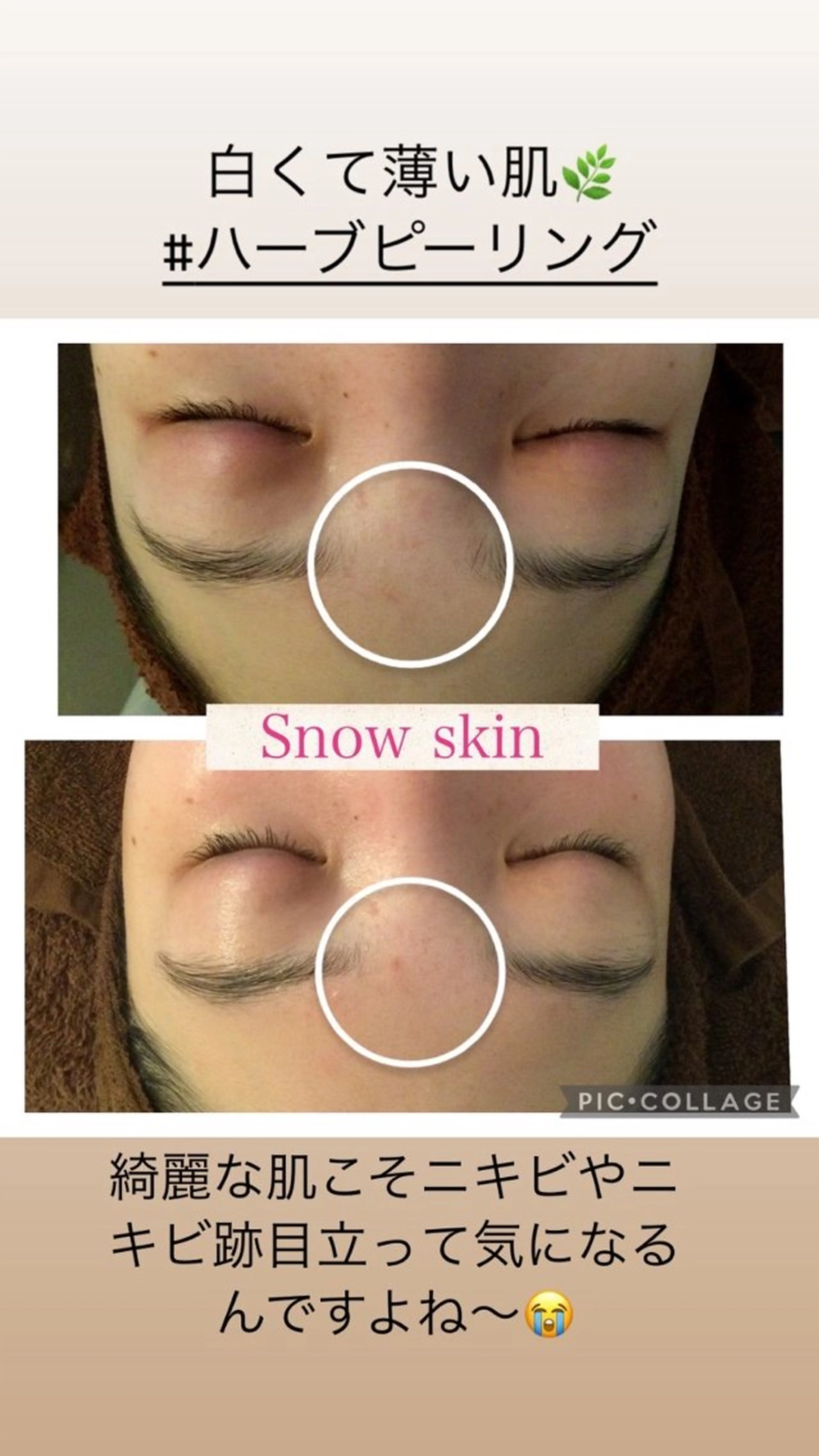 ニキビ/肌質改善専門 Snow skinのエステ・リラクイメージ