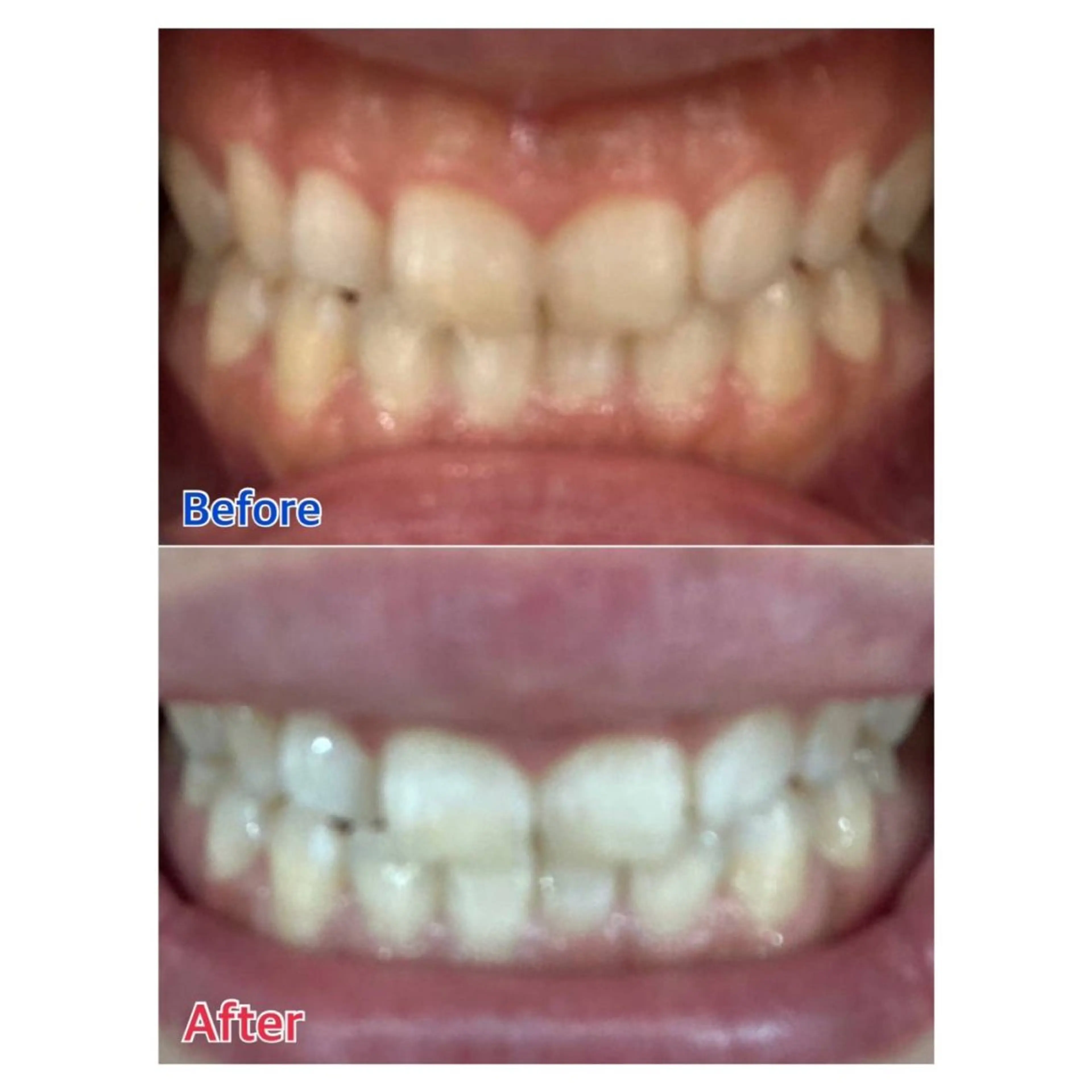 MBEAUTYSALON 千葉店・京成大久保所属・Melty 輝のその他イメージ