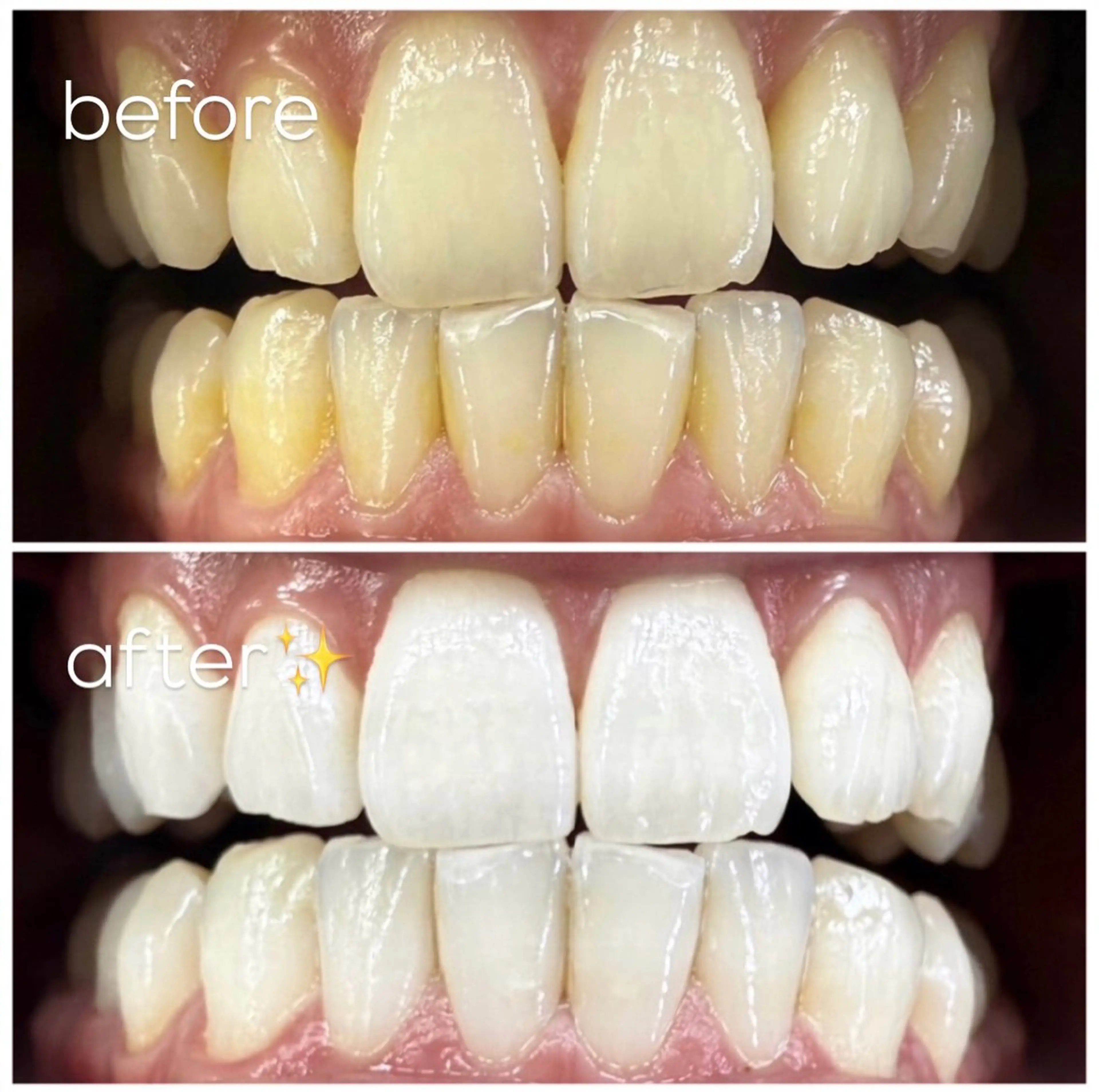 エクシア津駅前店所属・セルフホワイトニング エクシア津駅前店のその他イメージ
