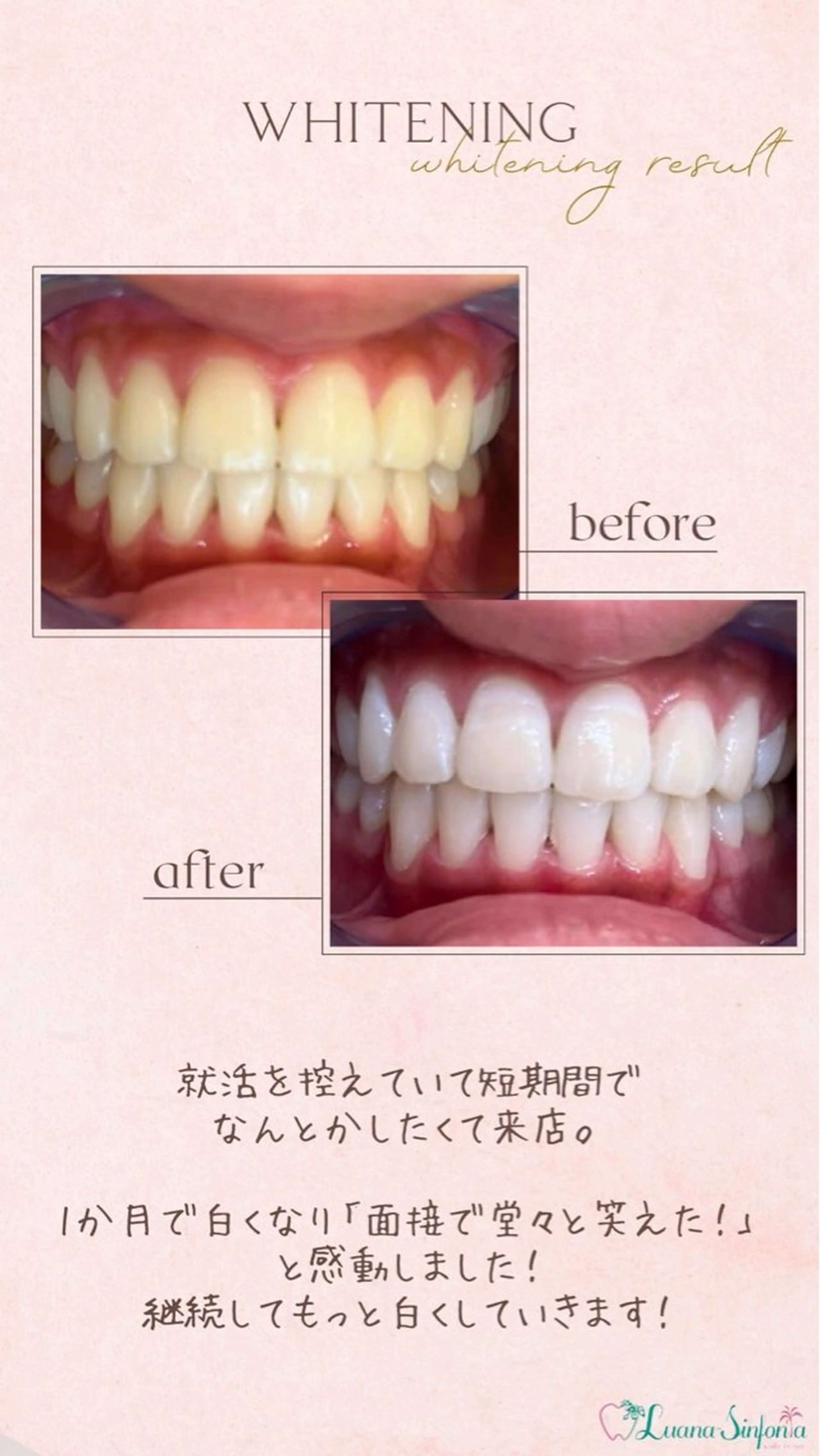 橋口 花菜子のその他イメージ