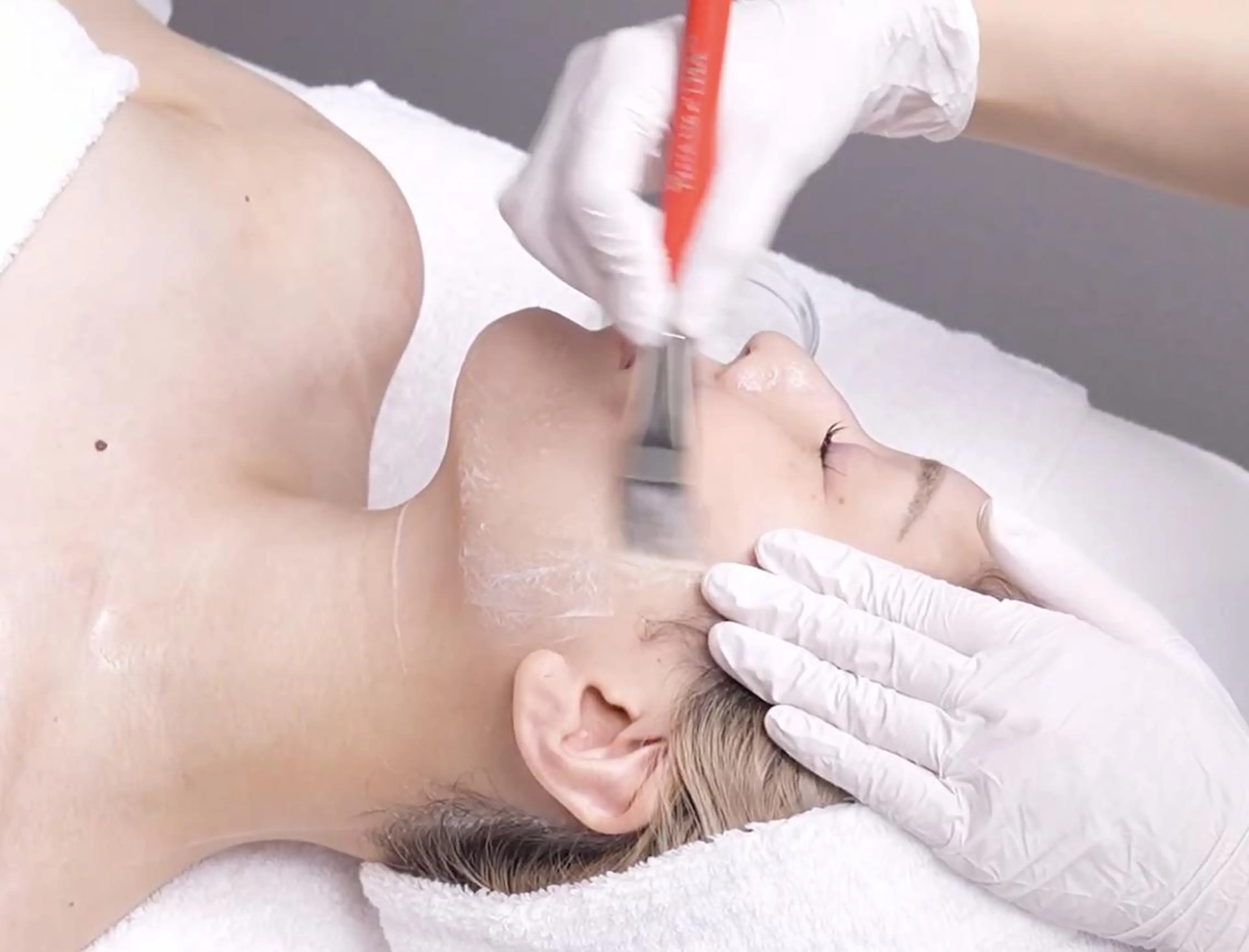 【全ての毛穴悩み/シミ】120分⭐️LHALA PEEL＋IPL⭐️韓国で人気 肌質ケアの定番の写真