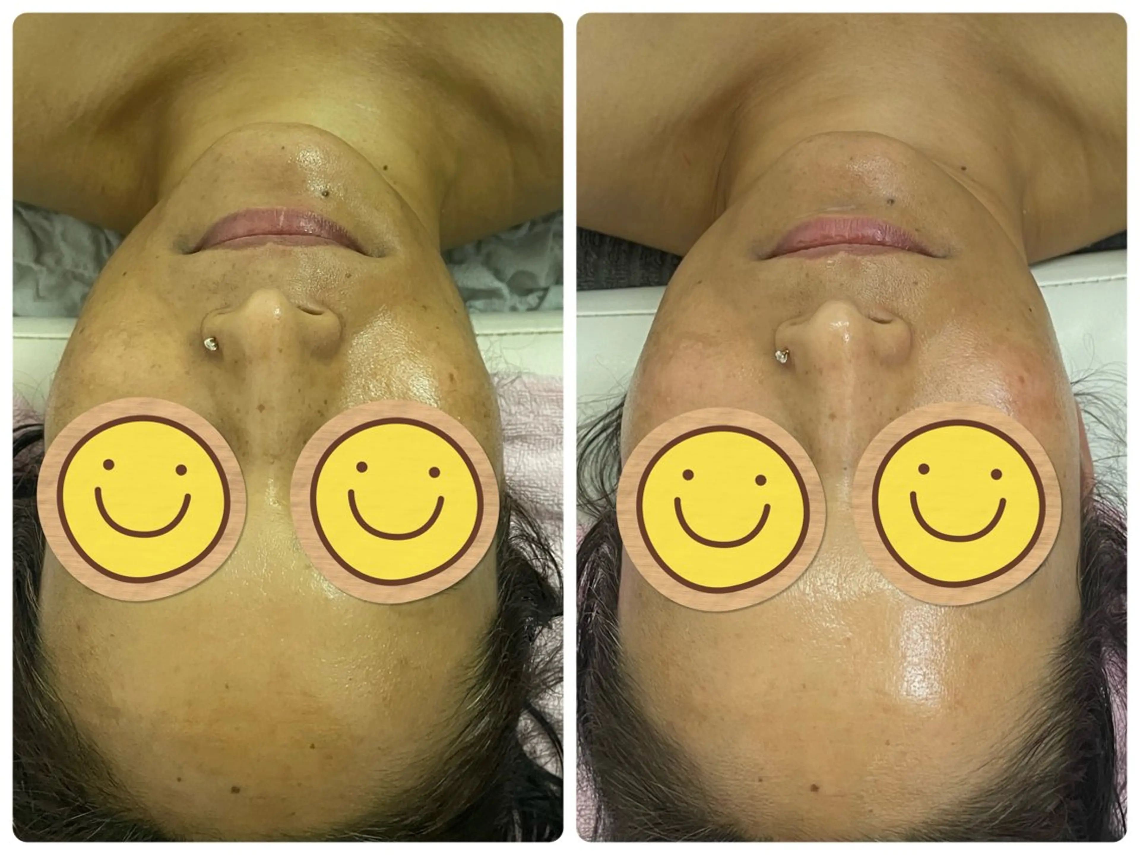 Salon Rion所属・Rion 野々村のエステ・リラクイメージ