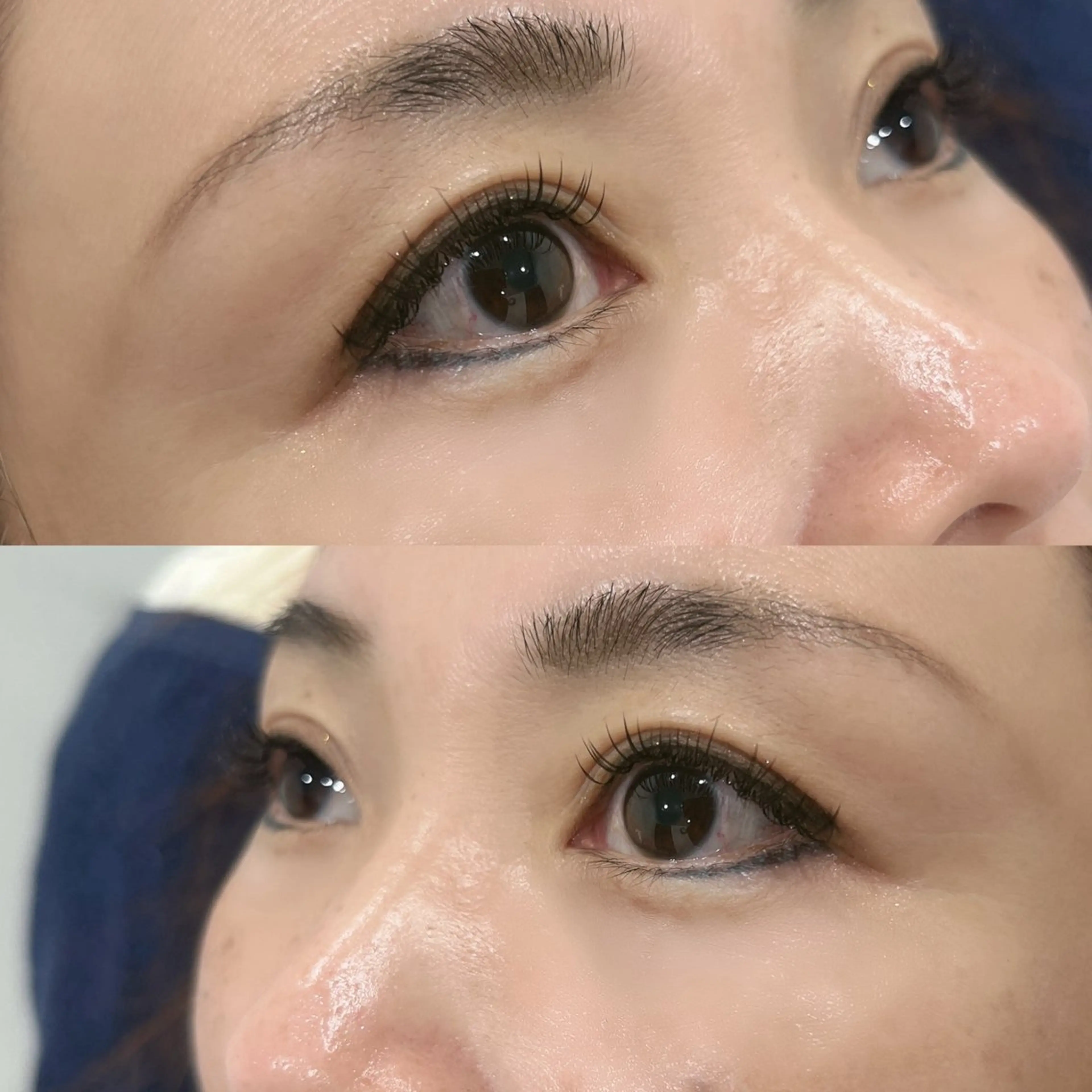 パーフェクトラッシュ140本の写真