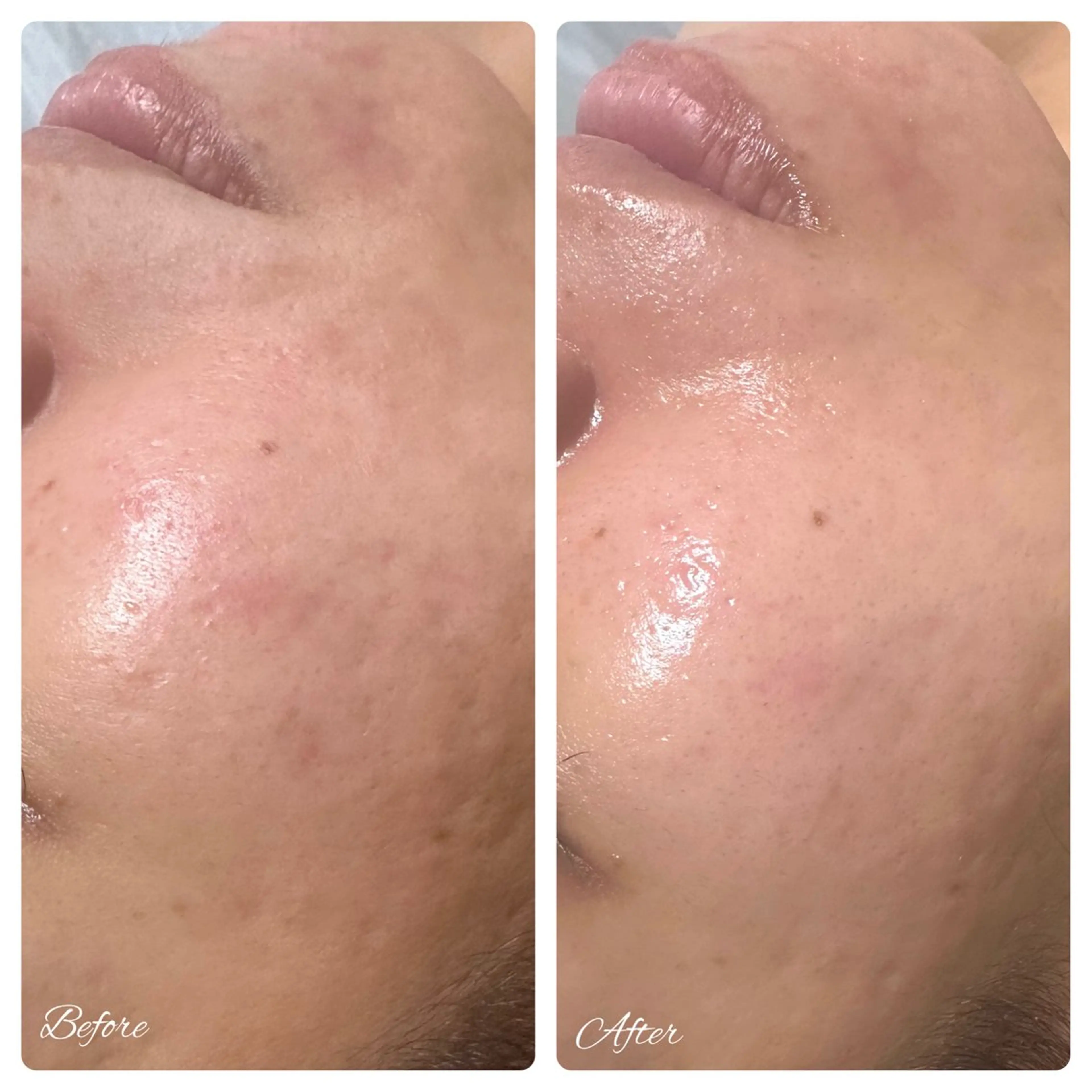 その他 SPA&BEAUTY Shanaのエステ・リラクイメージ