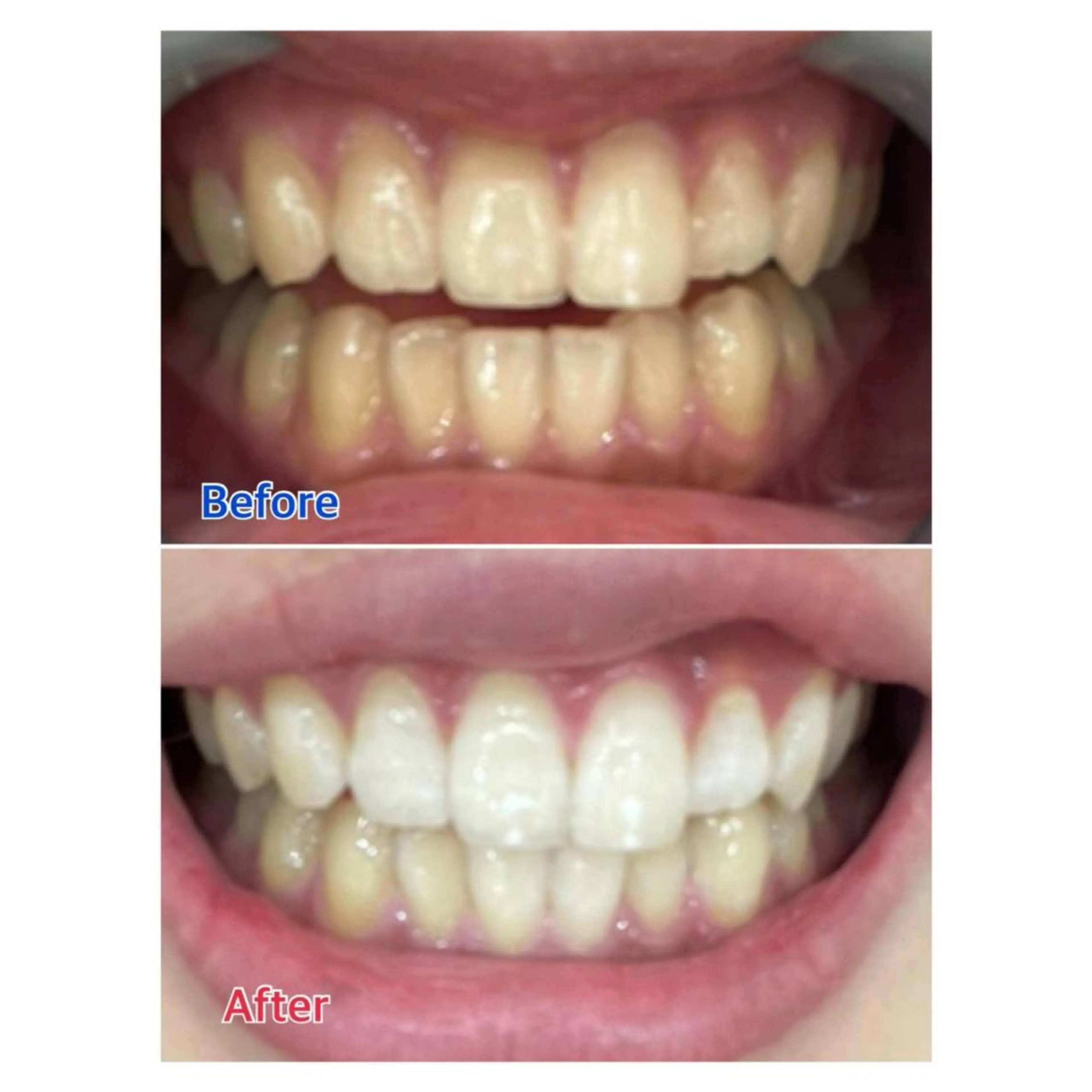 MBEAUTYSALON 千葉店・京成大久保所属・Melty 輝のその他イメージ