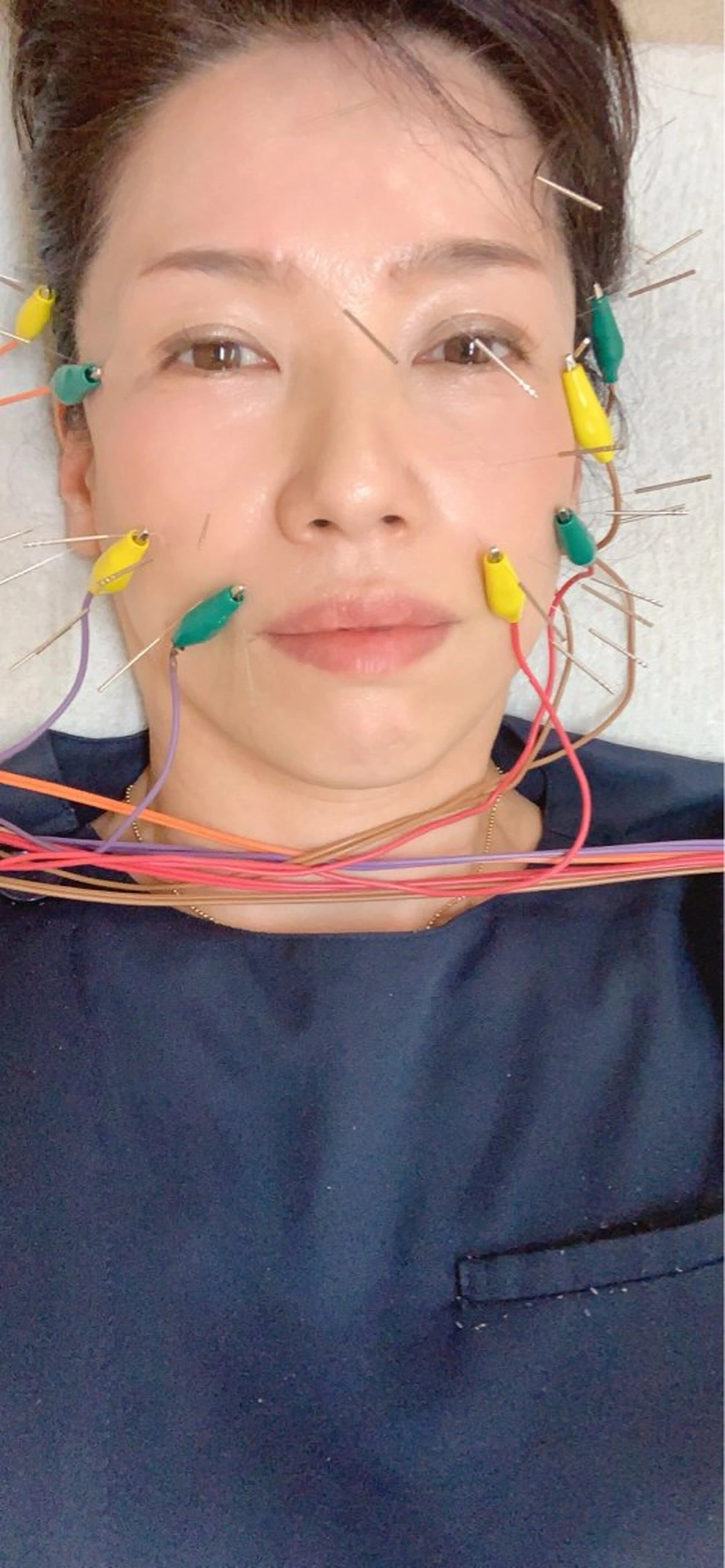 スリムスリムエステ にしお鍼灸院のその他イメージ