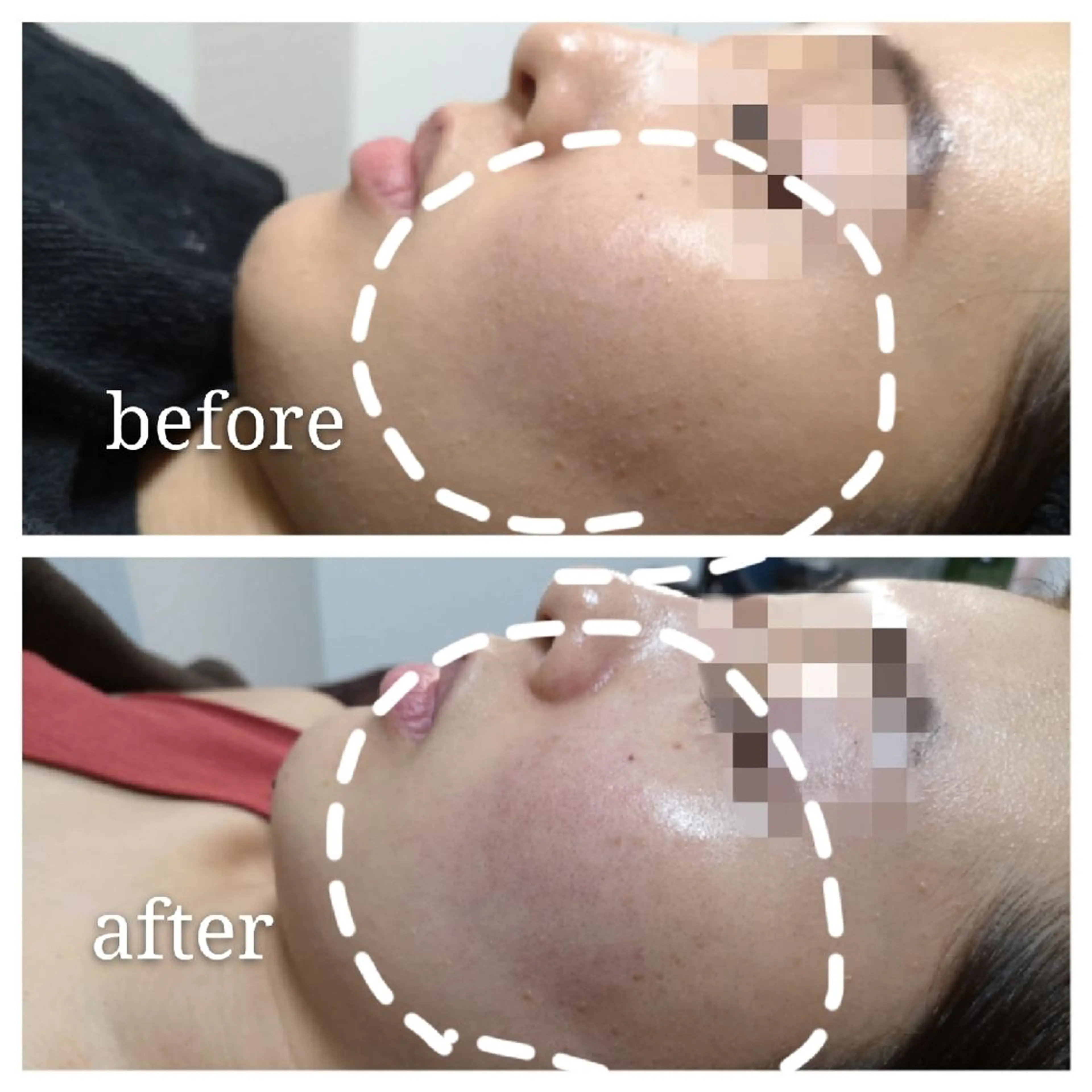 🅖🅤🅩🅔🅛 salonのエステ・リラクイメージ