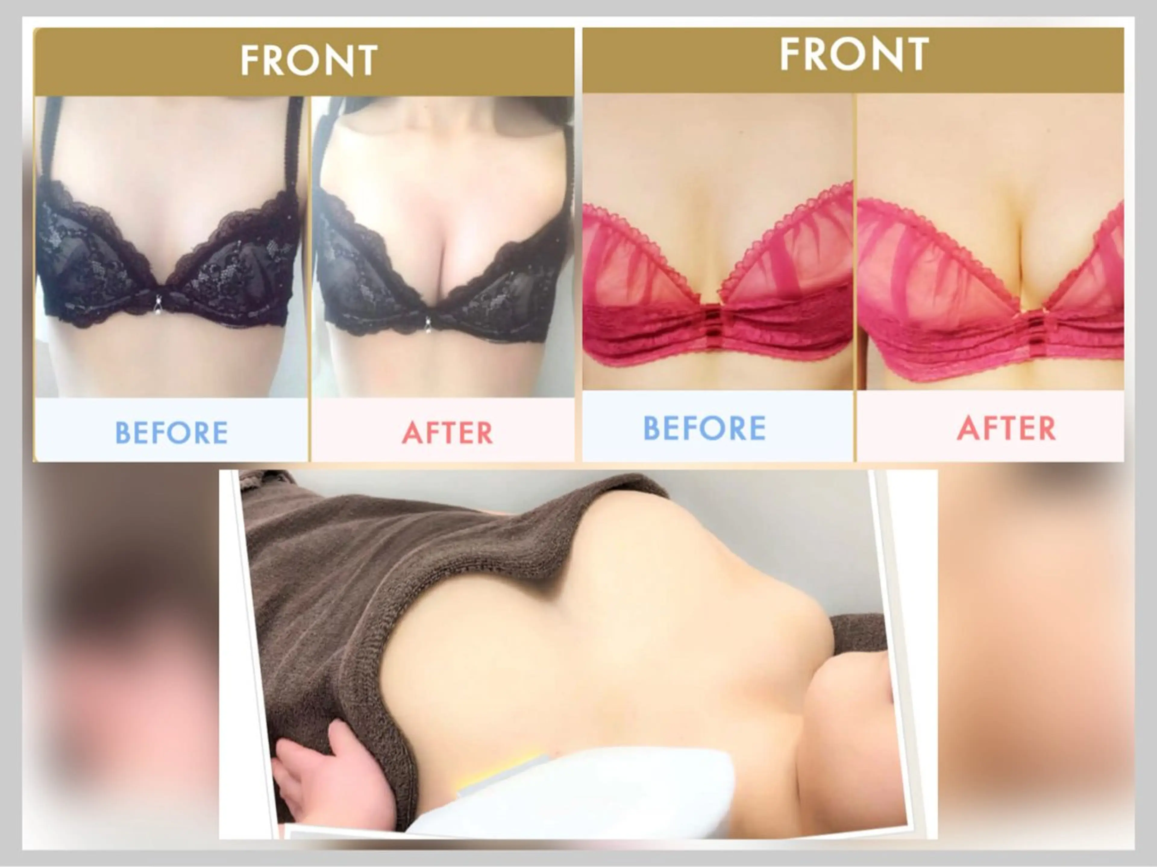 SHINY エステサロンのその他イメージ