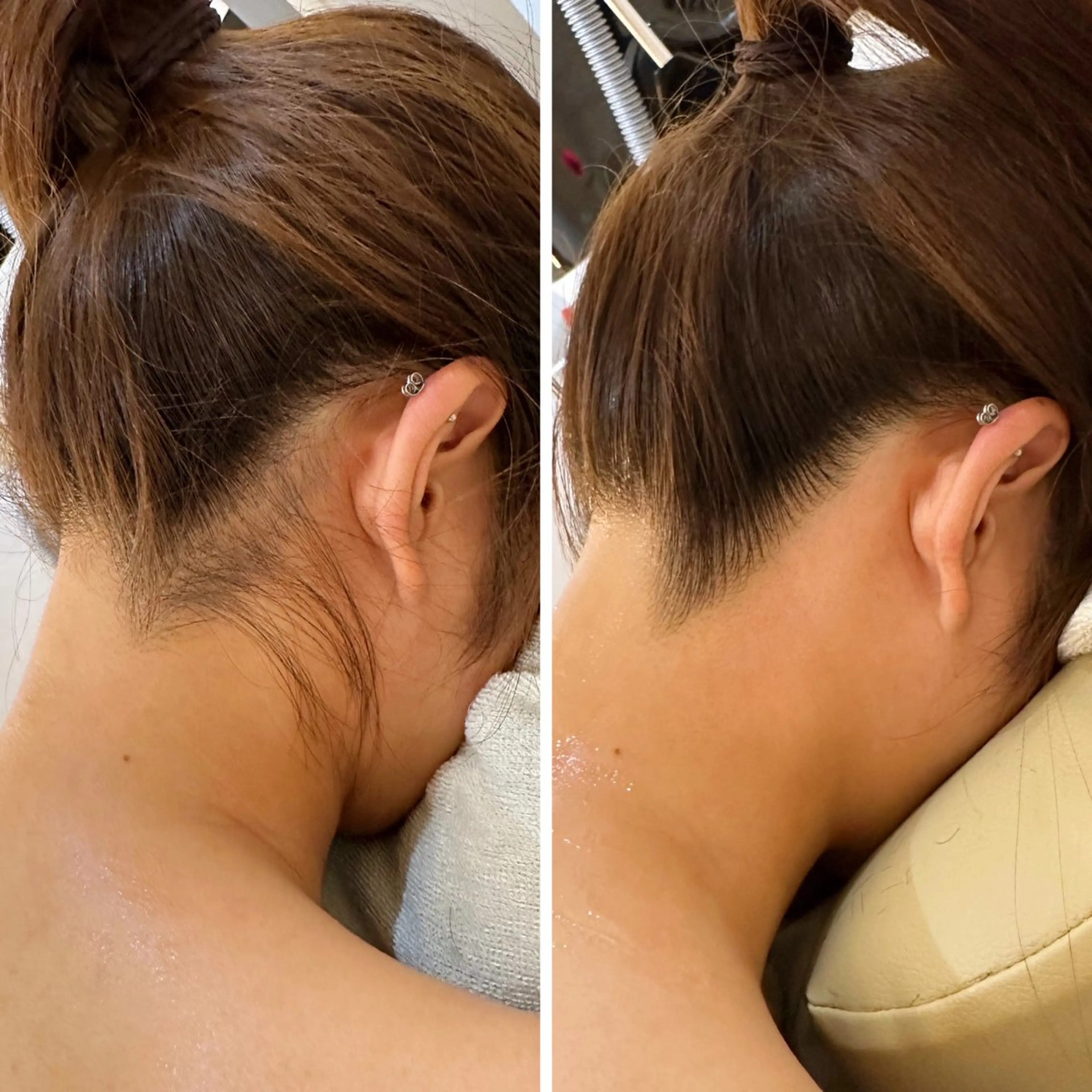 脱毛 うなじ脱毛/美肌脱毛 LABELのエステ・リラクイメージ