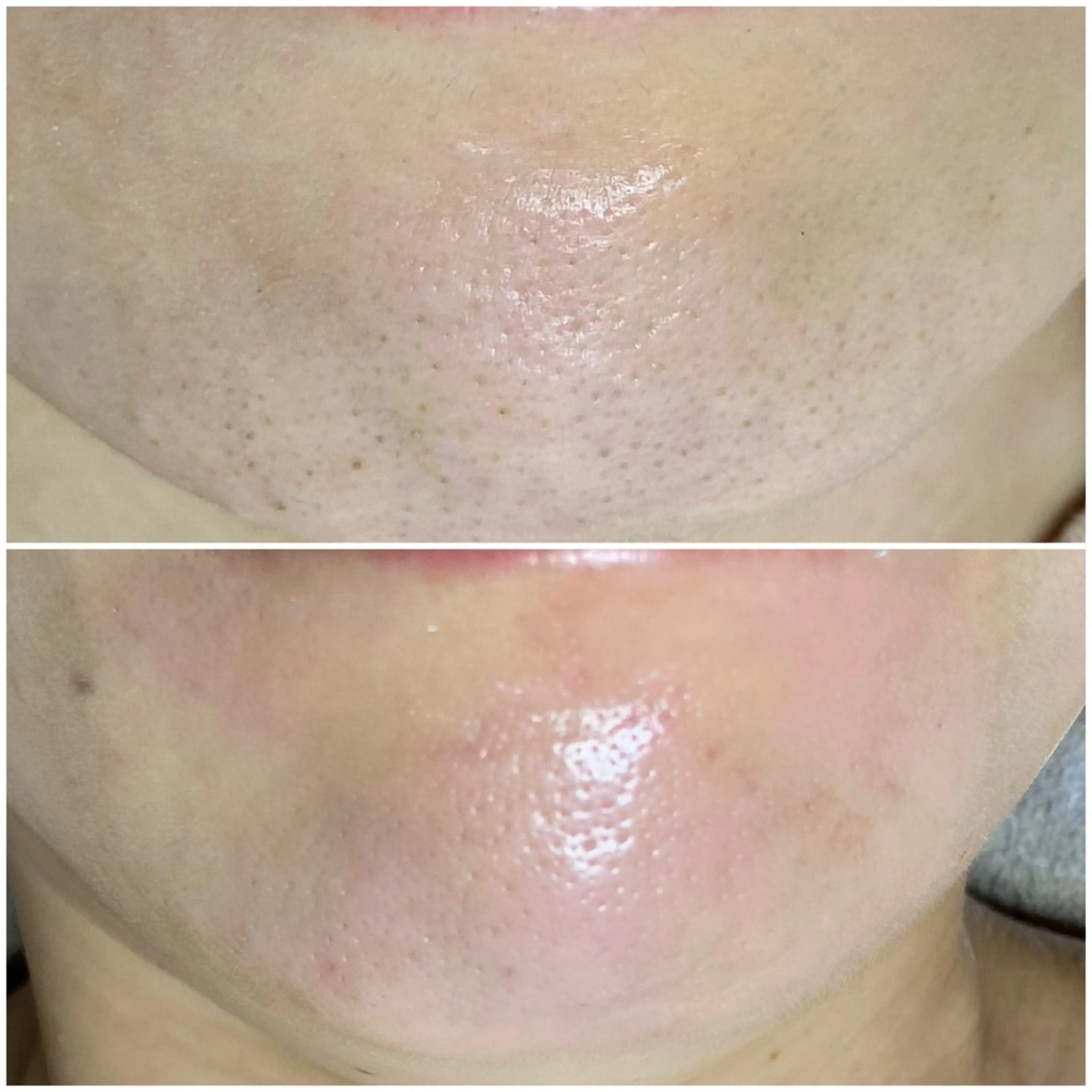 毛穴専門店RANA所属・毛穴専門店【各務原】 天使の毛穴のエステ・リラクイメージ