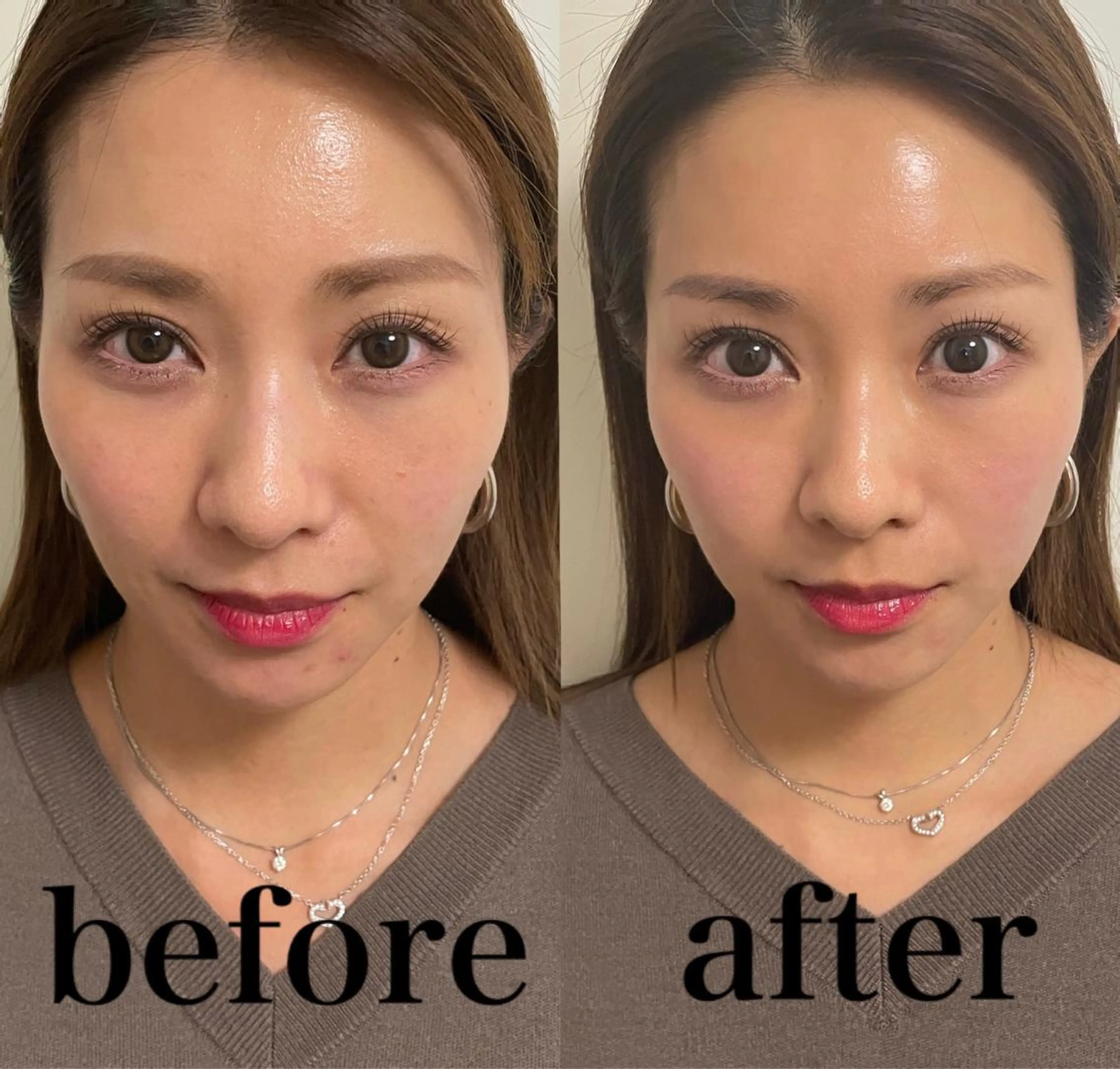 美容鍼灸サロン mahoroba院長のエステ・リラクイメージ