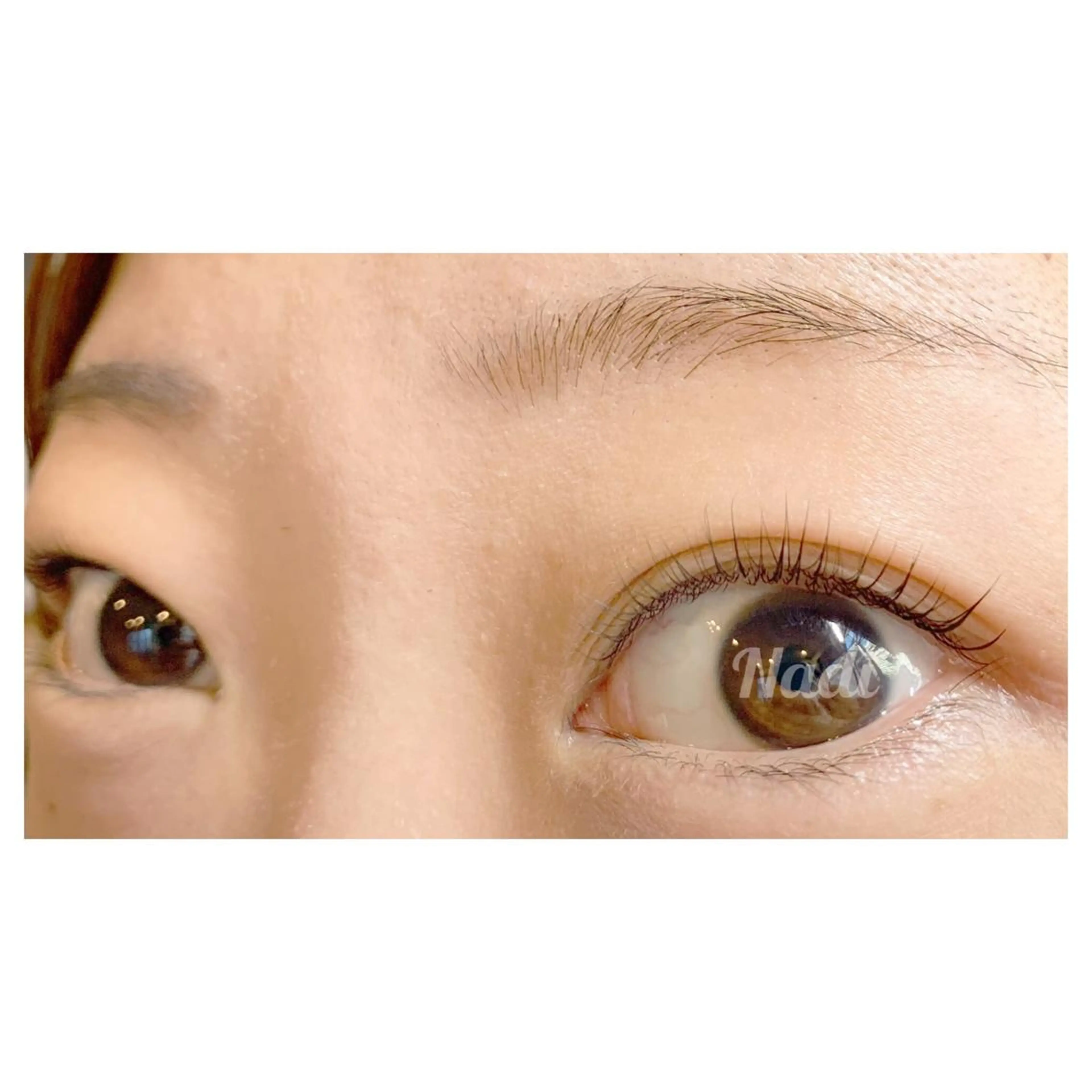 マツエク・マツパ ハーブピーリング専門EMILUCA藤沢所属・ハーブピーリング /KAEDEのエステ・リラクイメージ