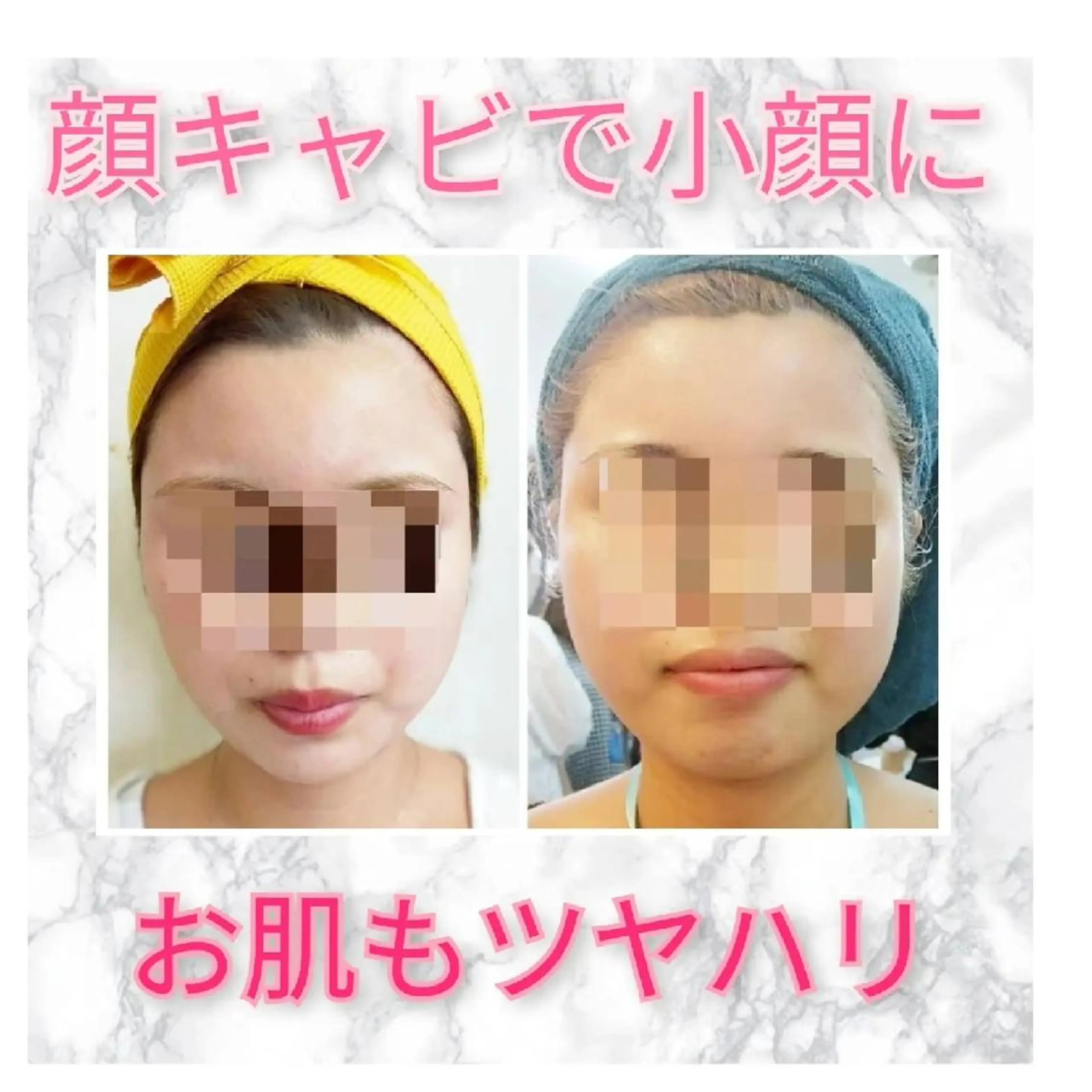 ミニモ限定🌟顔痩せ✧デトックス小顔フェイシャル✧の写真