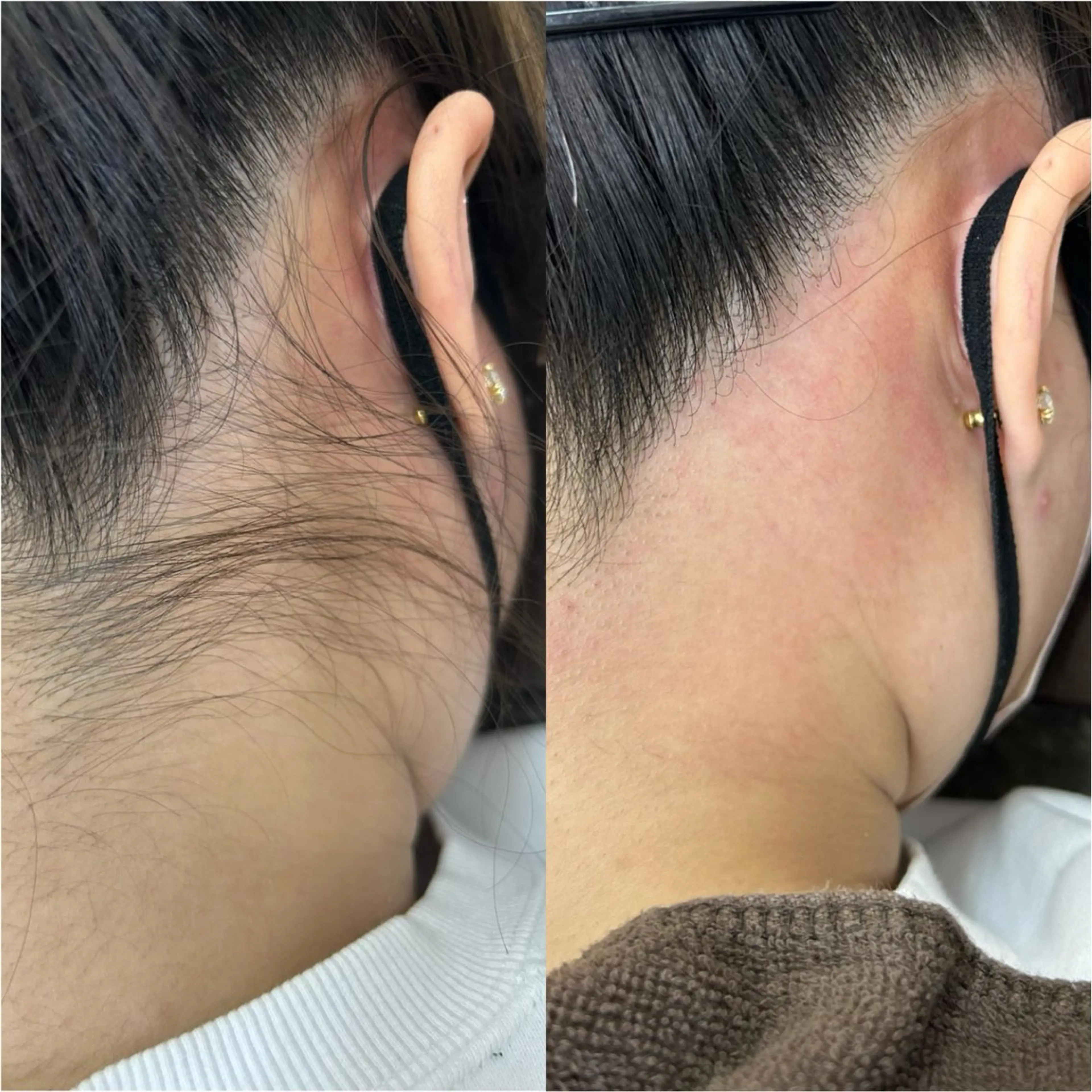 ⚫︎うなじWaxの写真