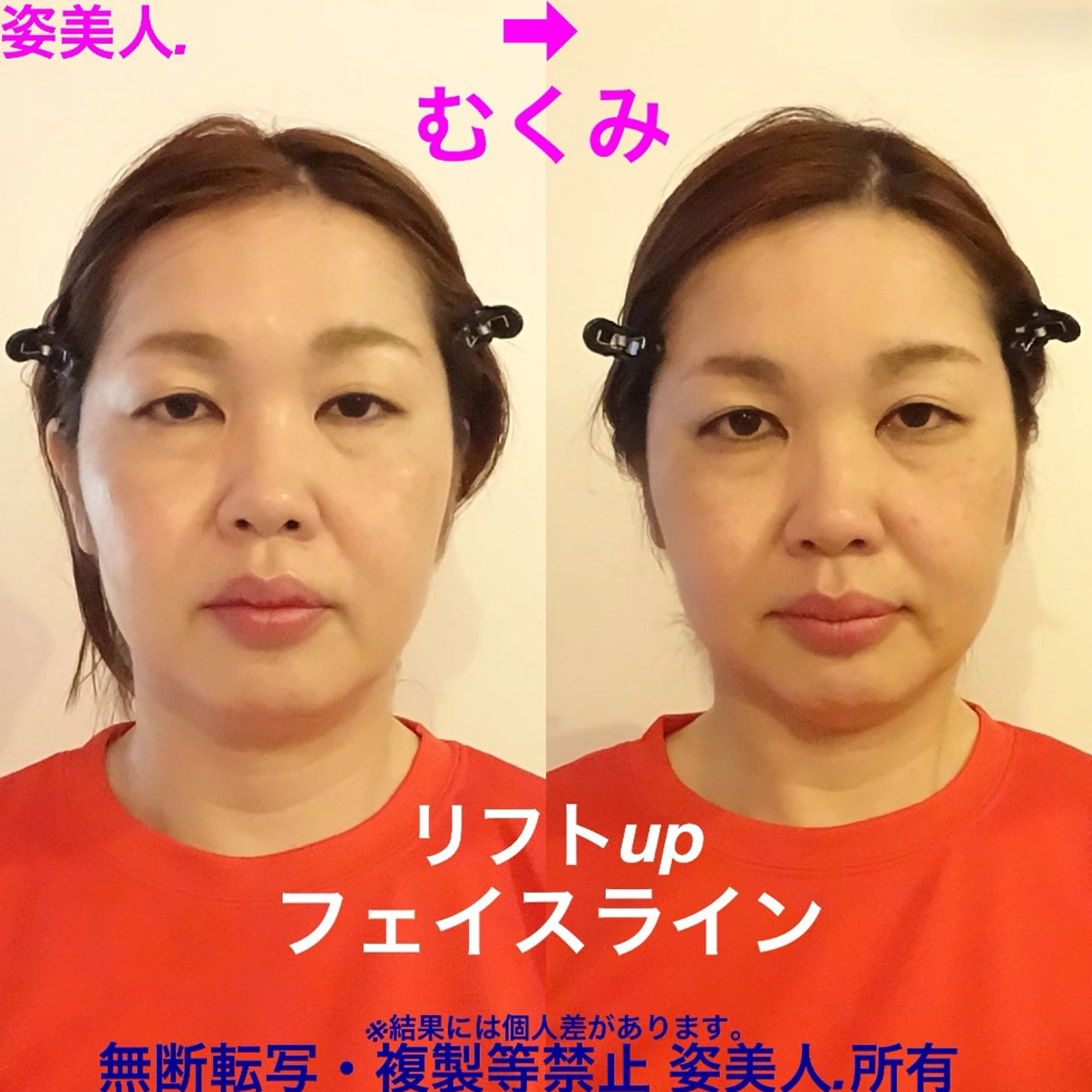 筋膜整体＆小顔矯正 　姿美人.シルエットのエステ・リラクイメージ