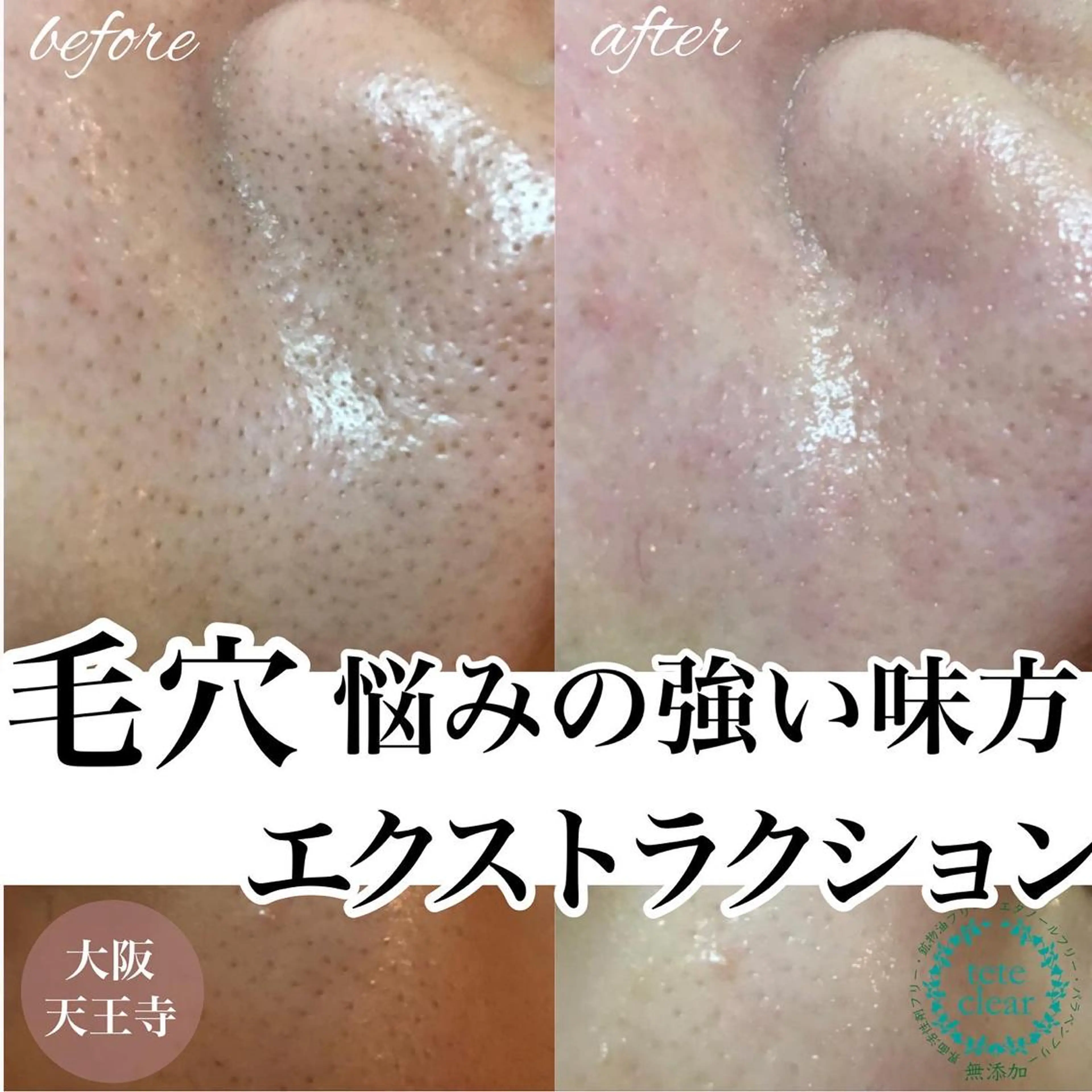 アイブロウ 【しみ毛穴専門店】beautysalon Ankh所属・しみ毛穴専門店 Ankh 平田のエステ・リラクイメージ